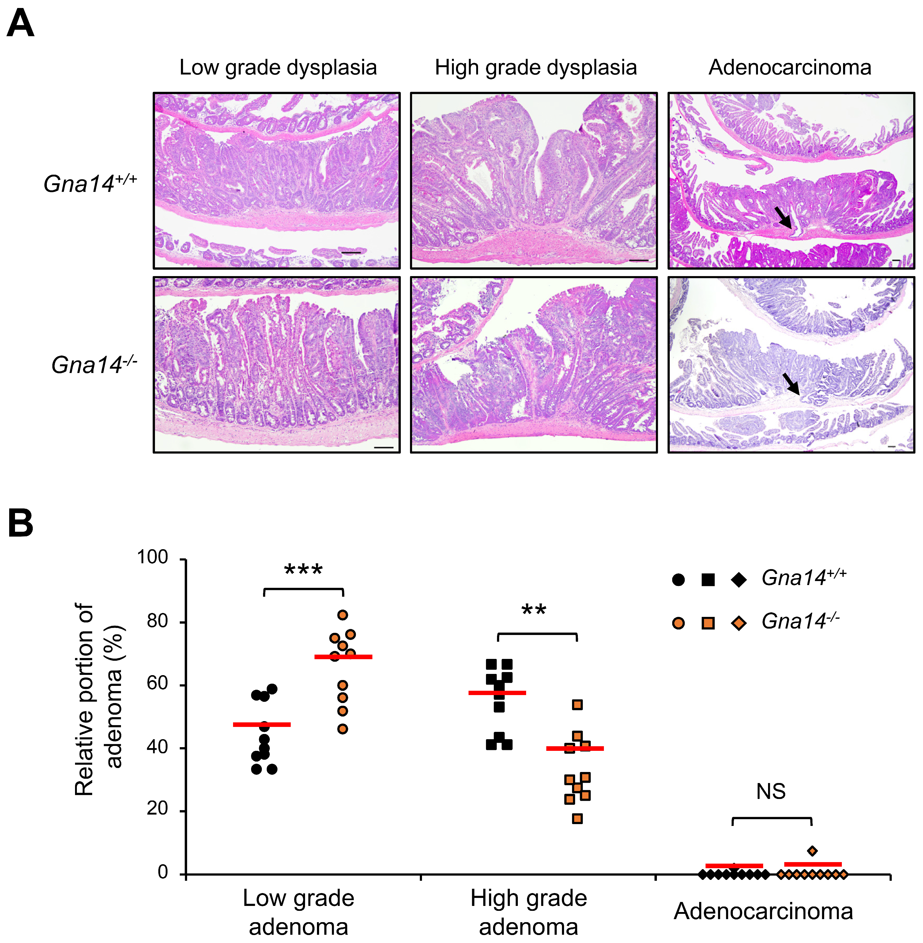 Cancers 15 04572 g004 Cancers 15 04572 g004