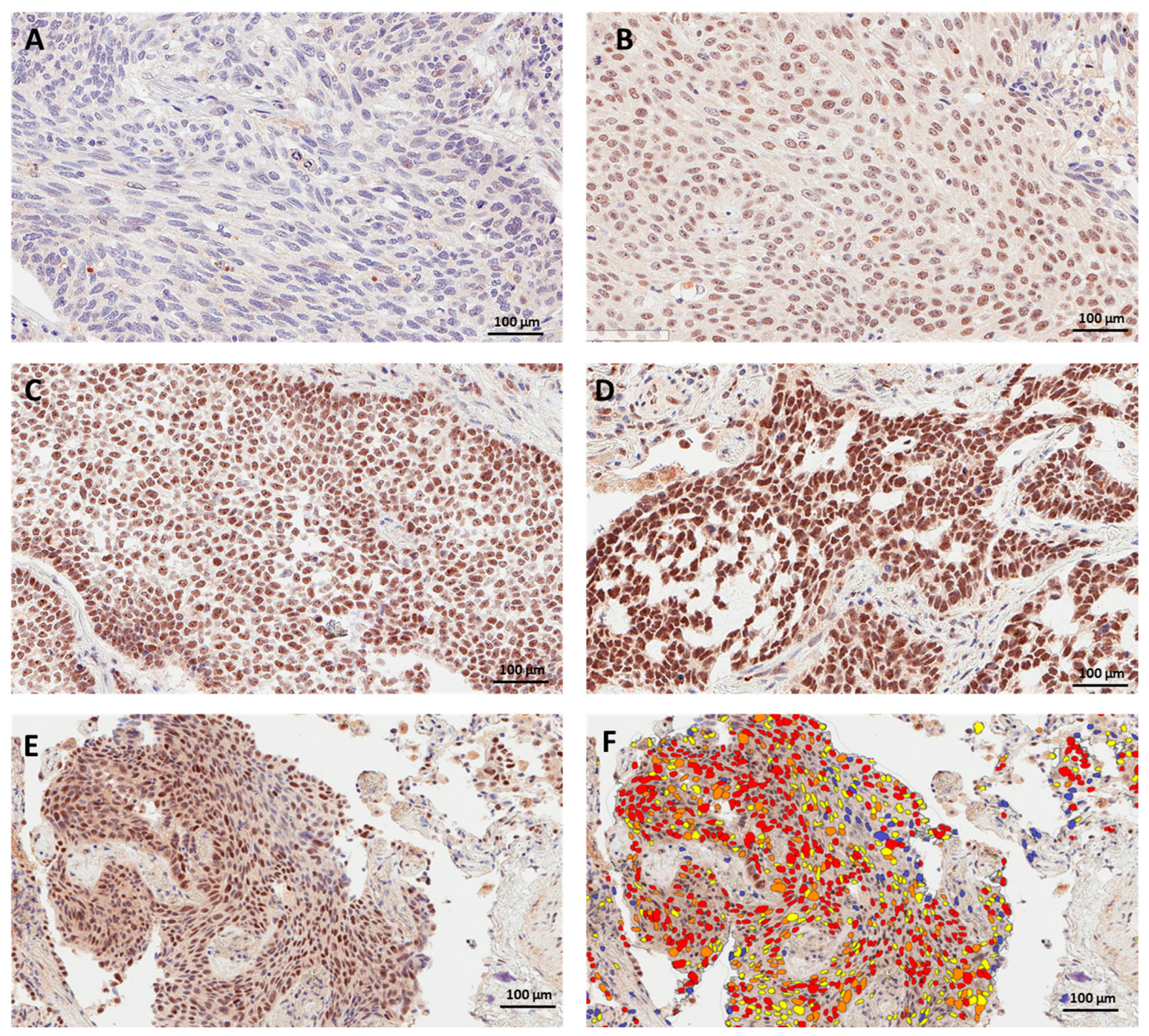 Cancers 15 04582 g001