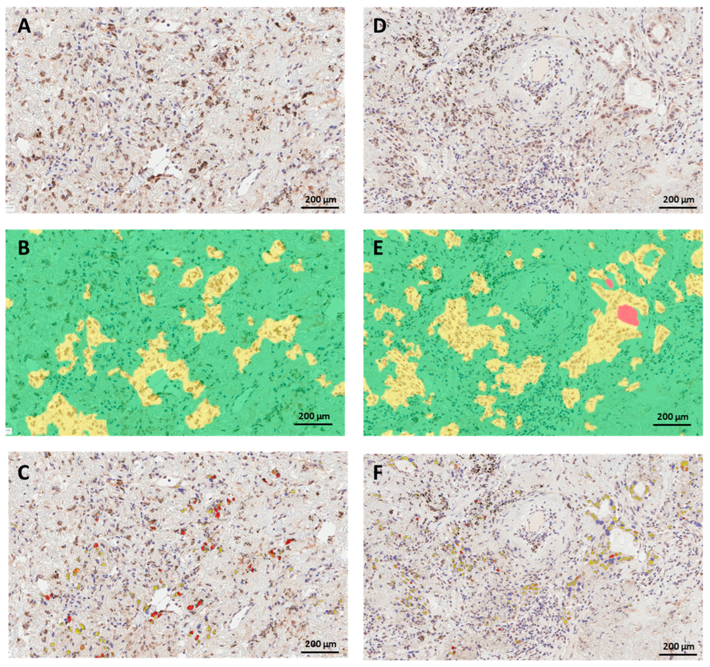 Cancers 15 04582 g003