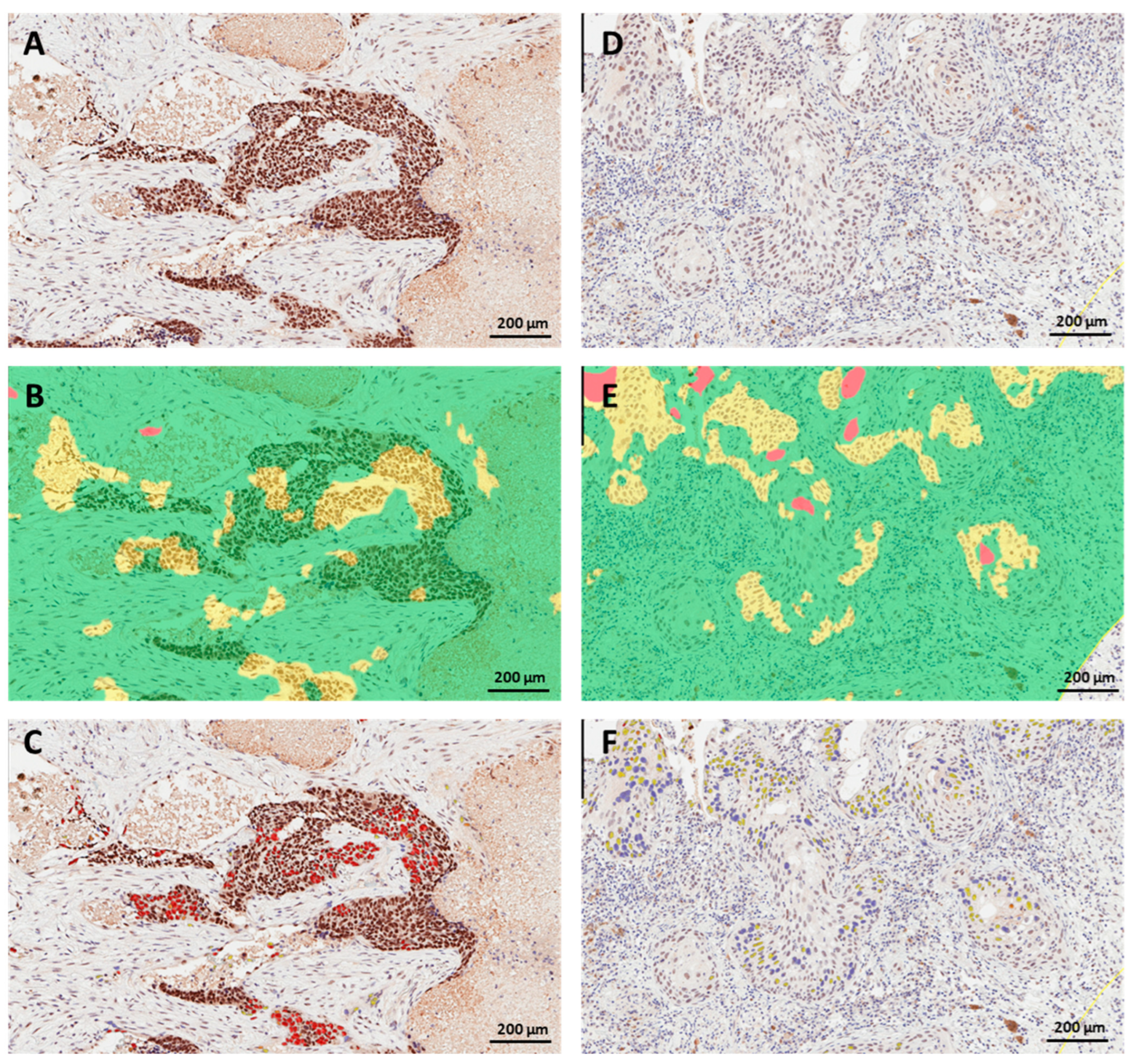 Cancers 15 04582 g004