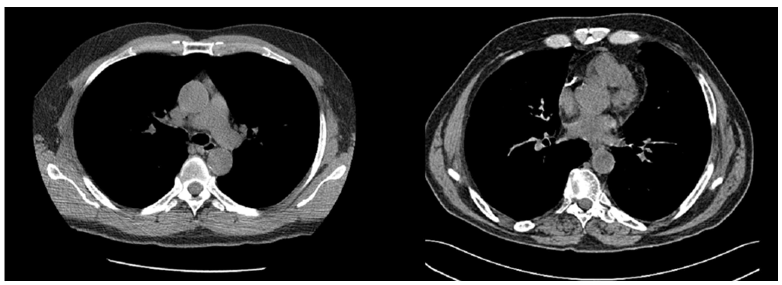 Cancers 15 04655 g001