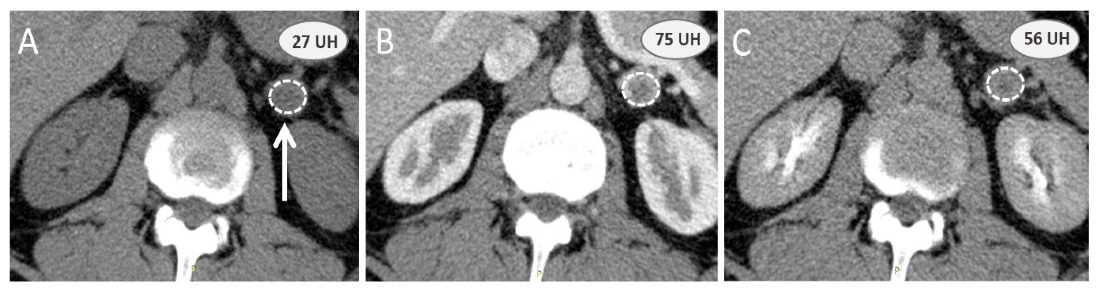 Cancers 15 04666 g001