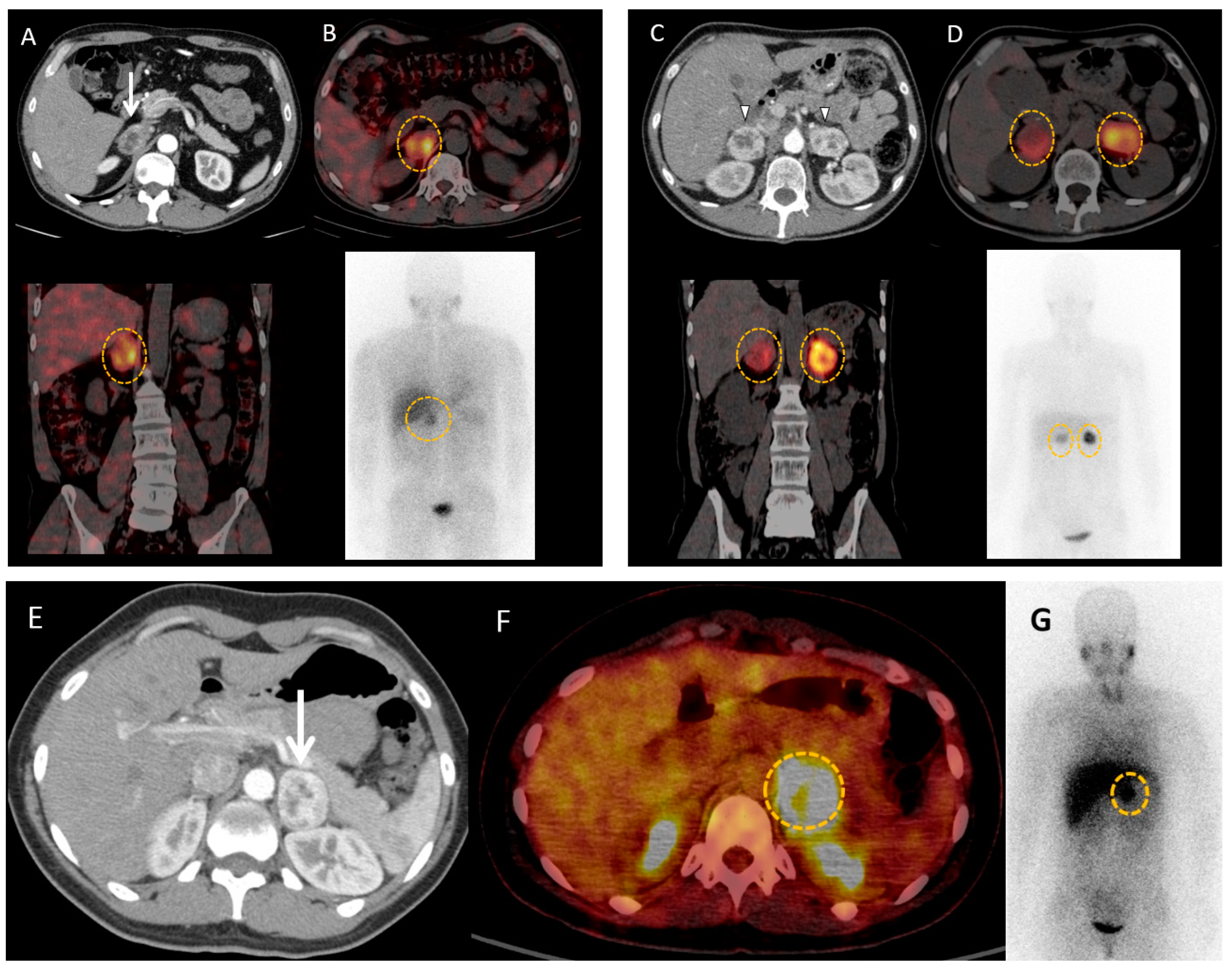 Cancers 15 04666 g004