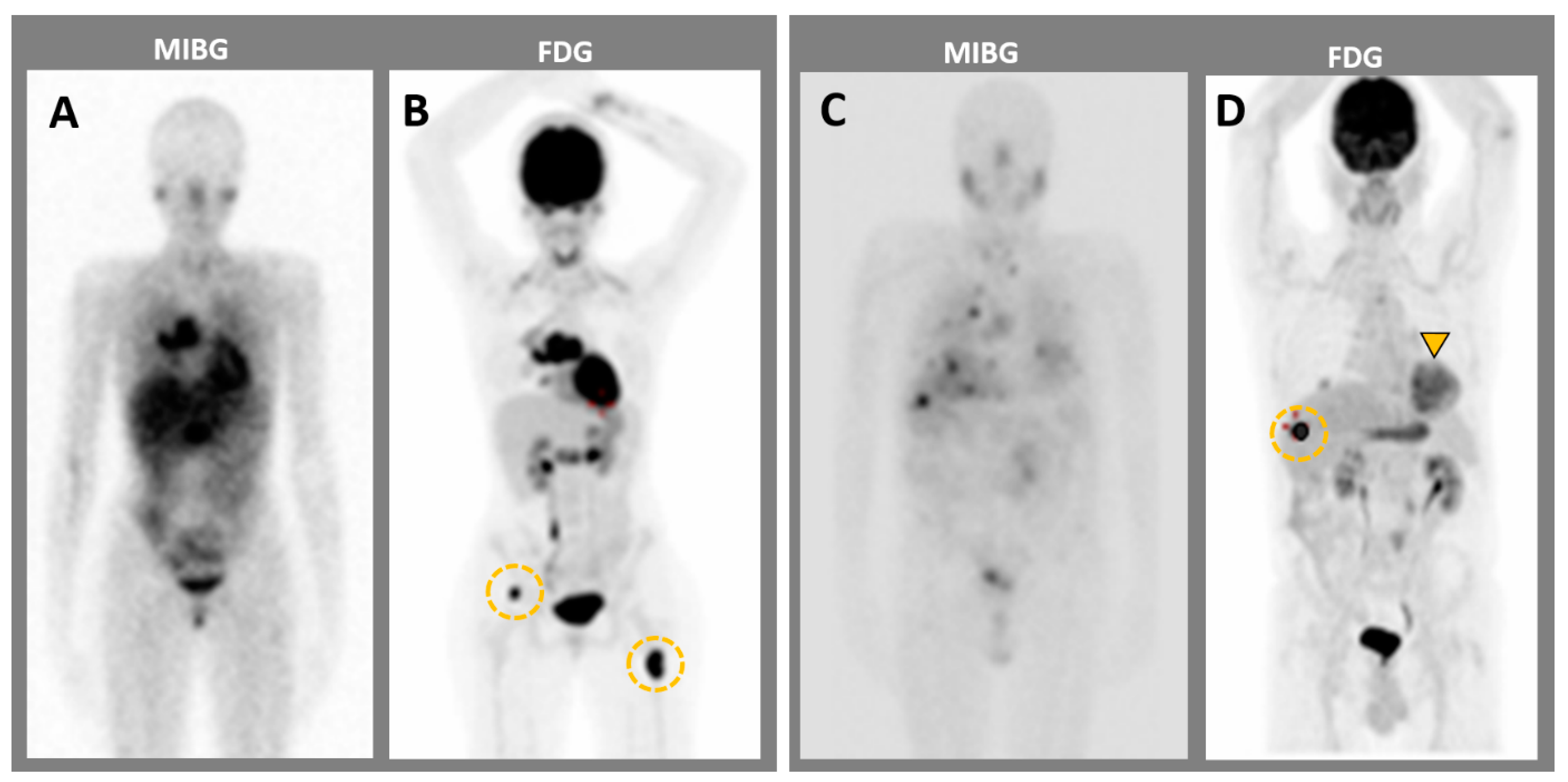 Cancers 15 04666 g005