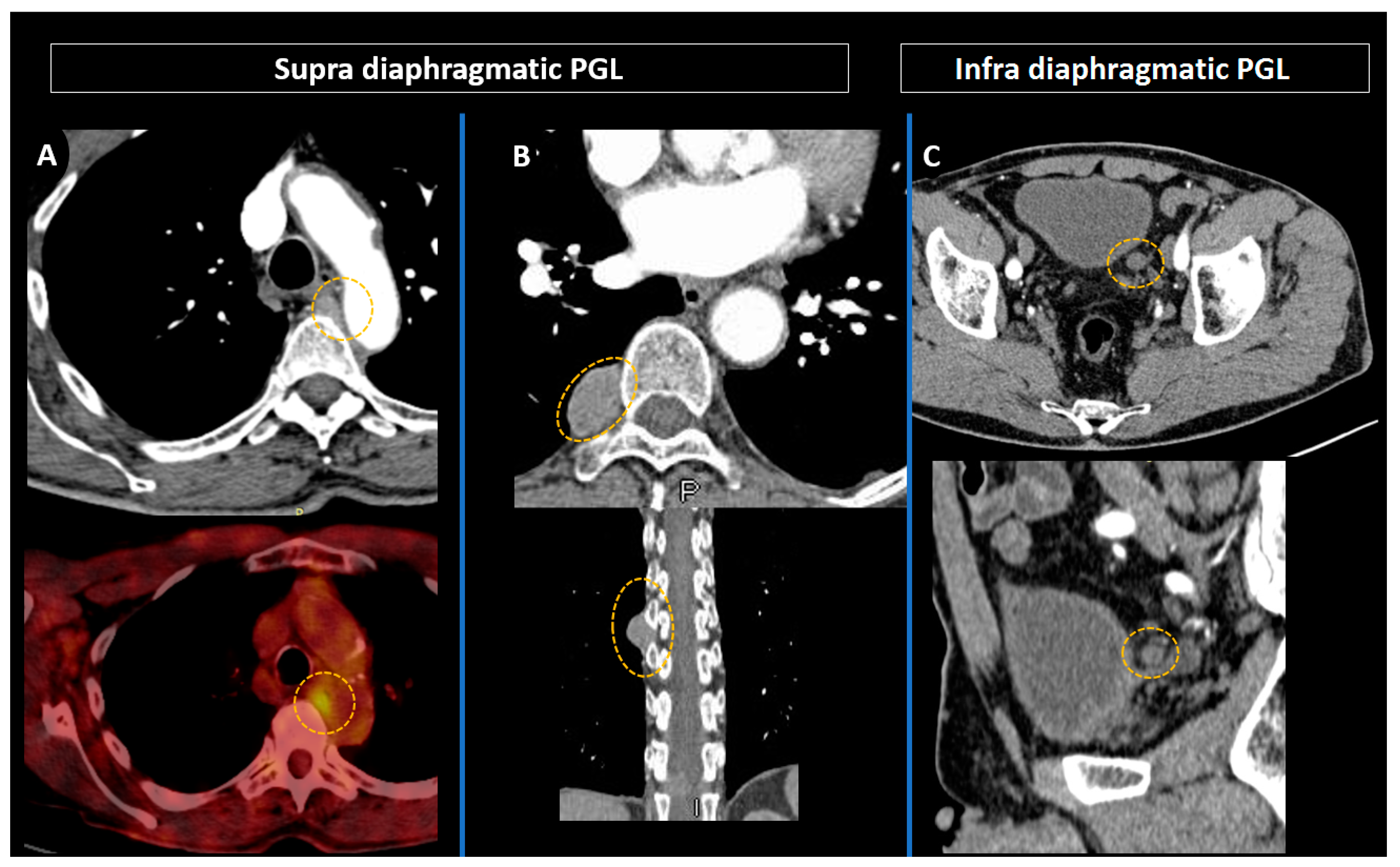 Cancers 15 04666 g007