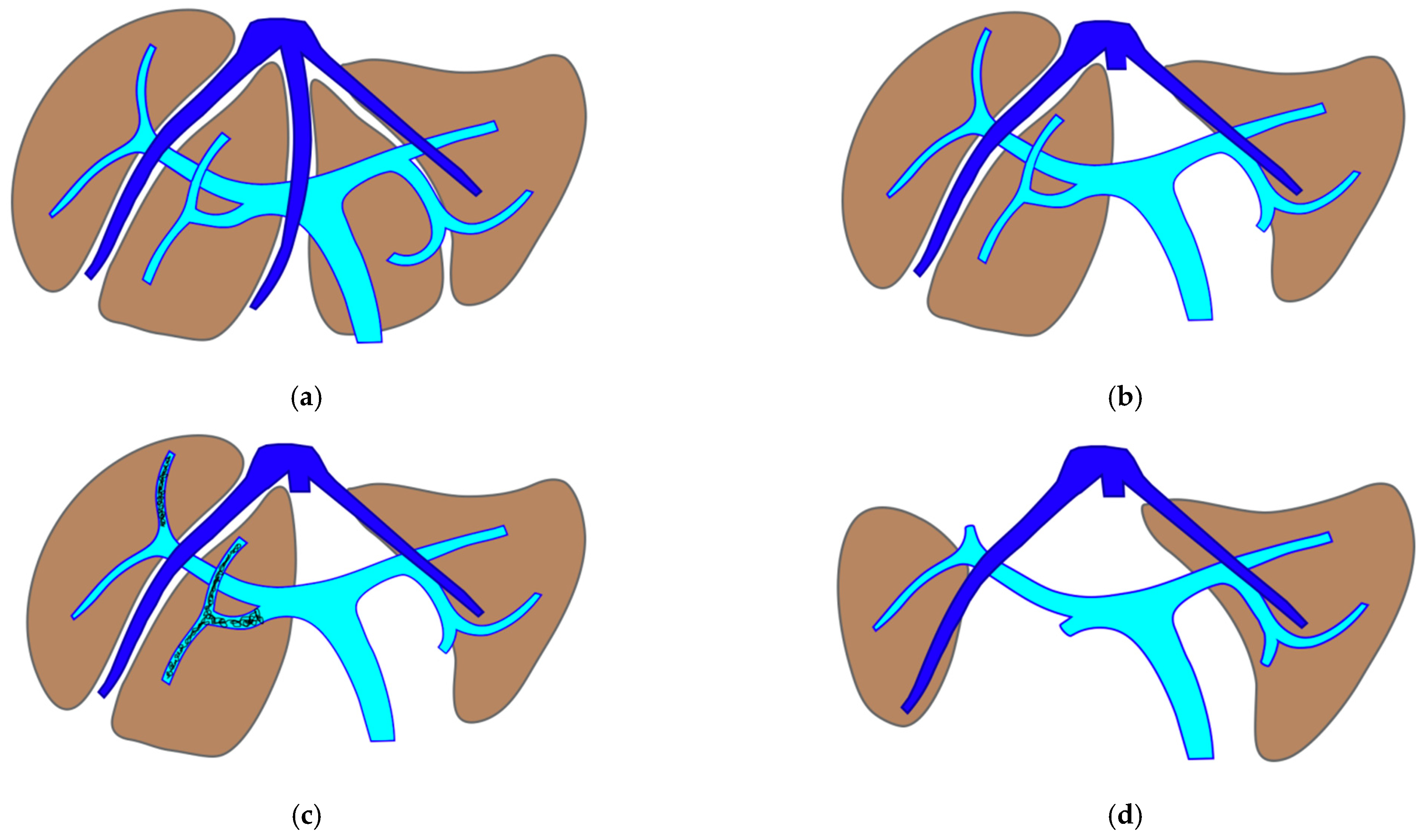 Cancers 15 04683 g001