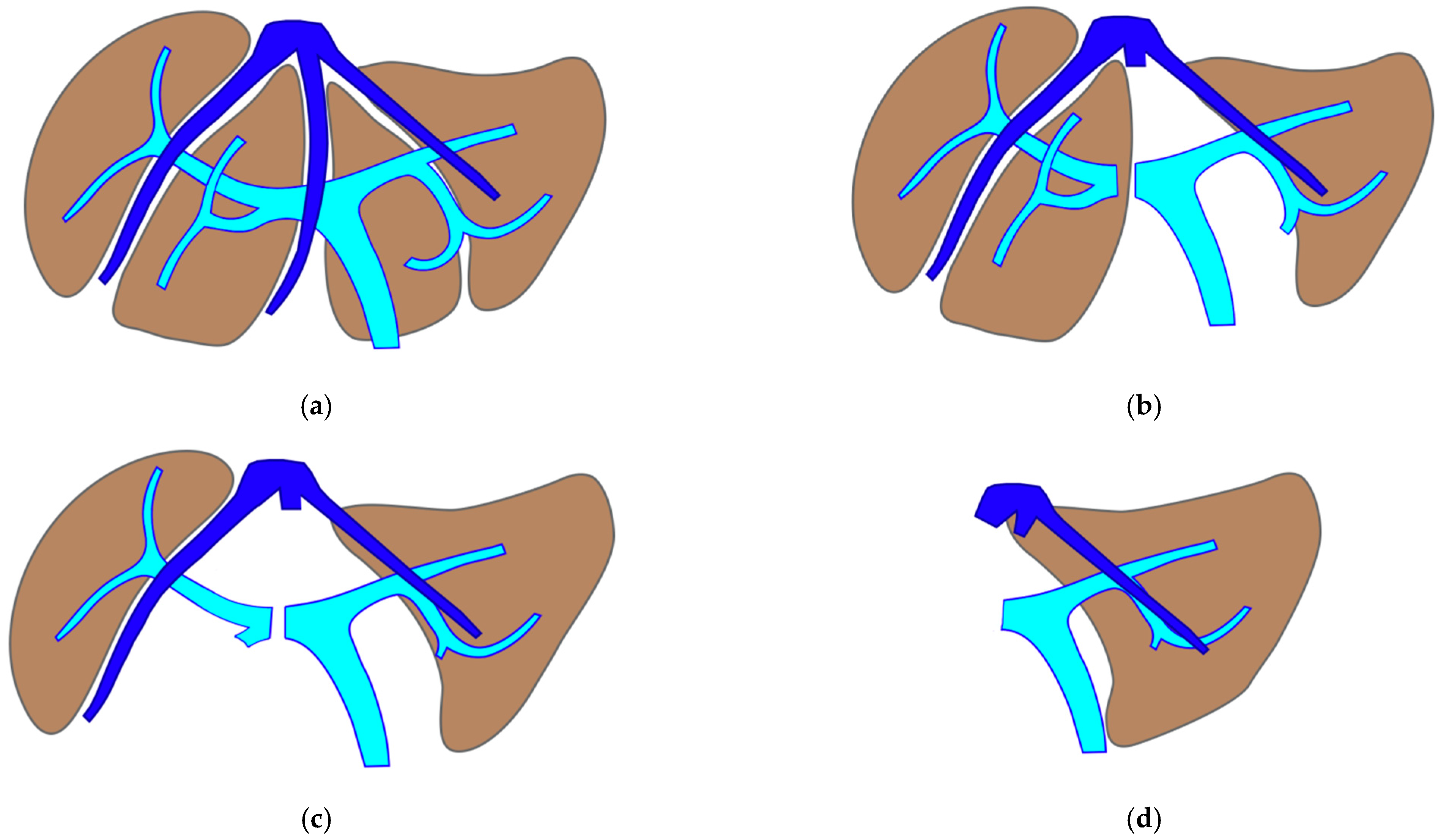 Cancers 15 04683 g002