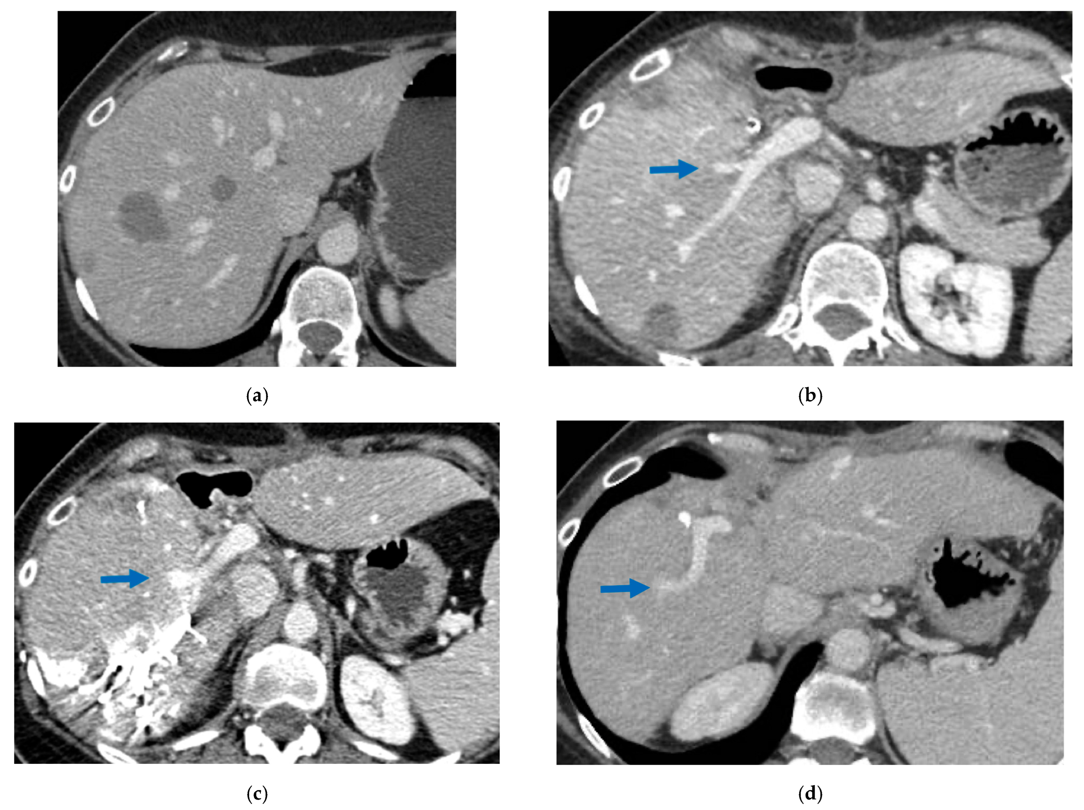 Cancers 15 04683 g006