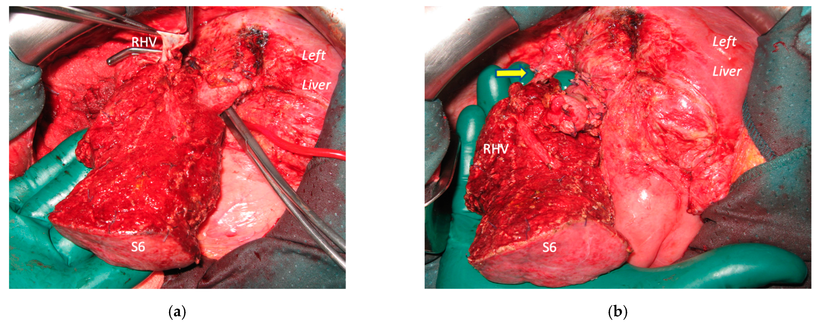 Cancers 15 04683 g008