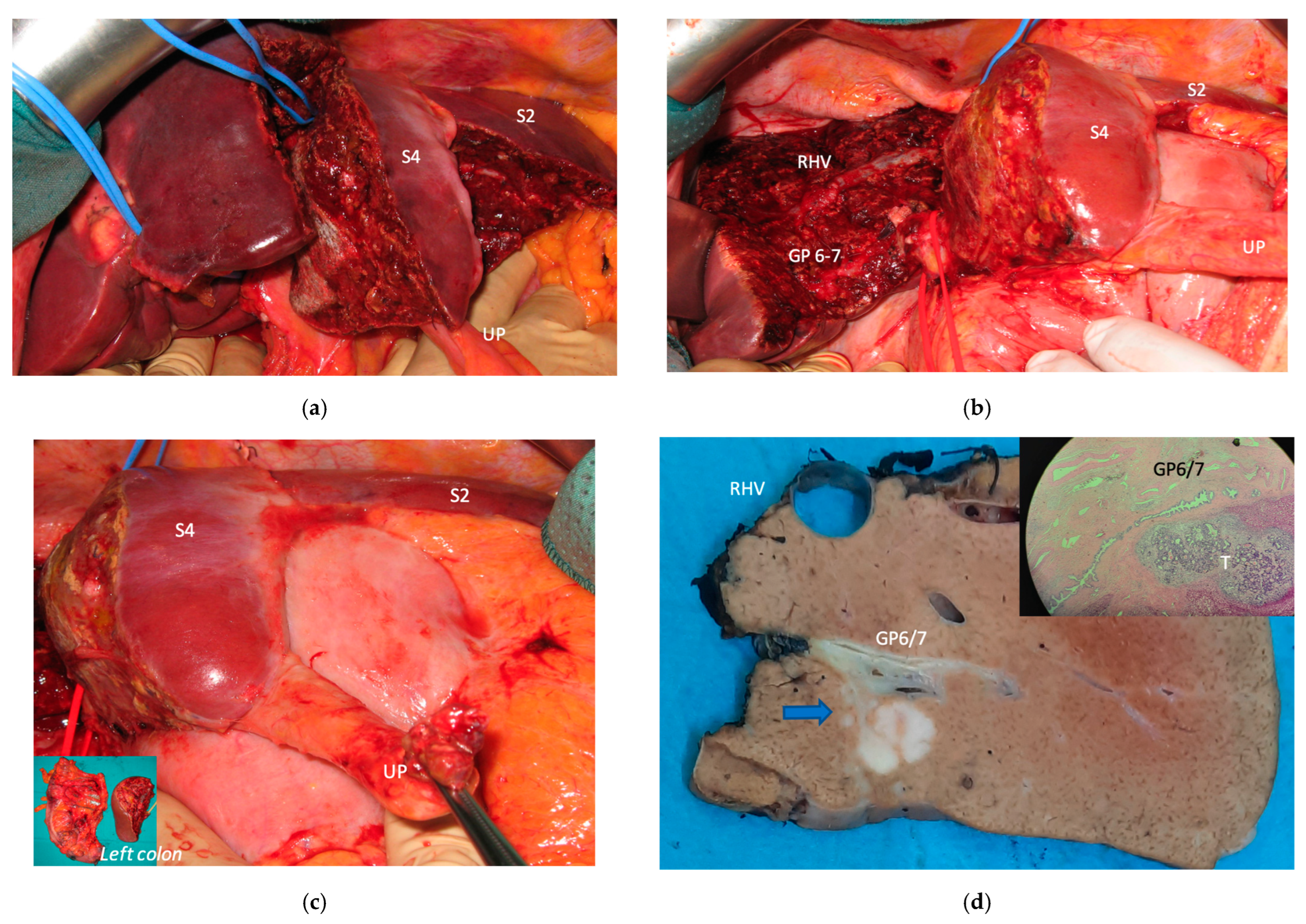 Cancers 15 04683 g013