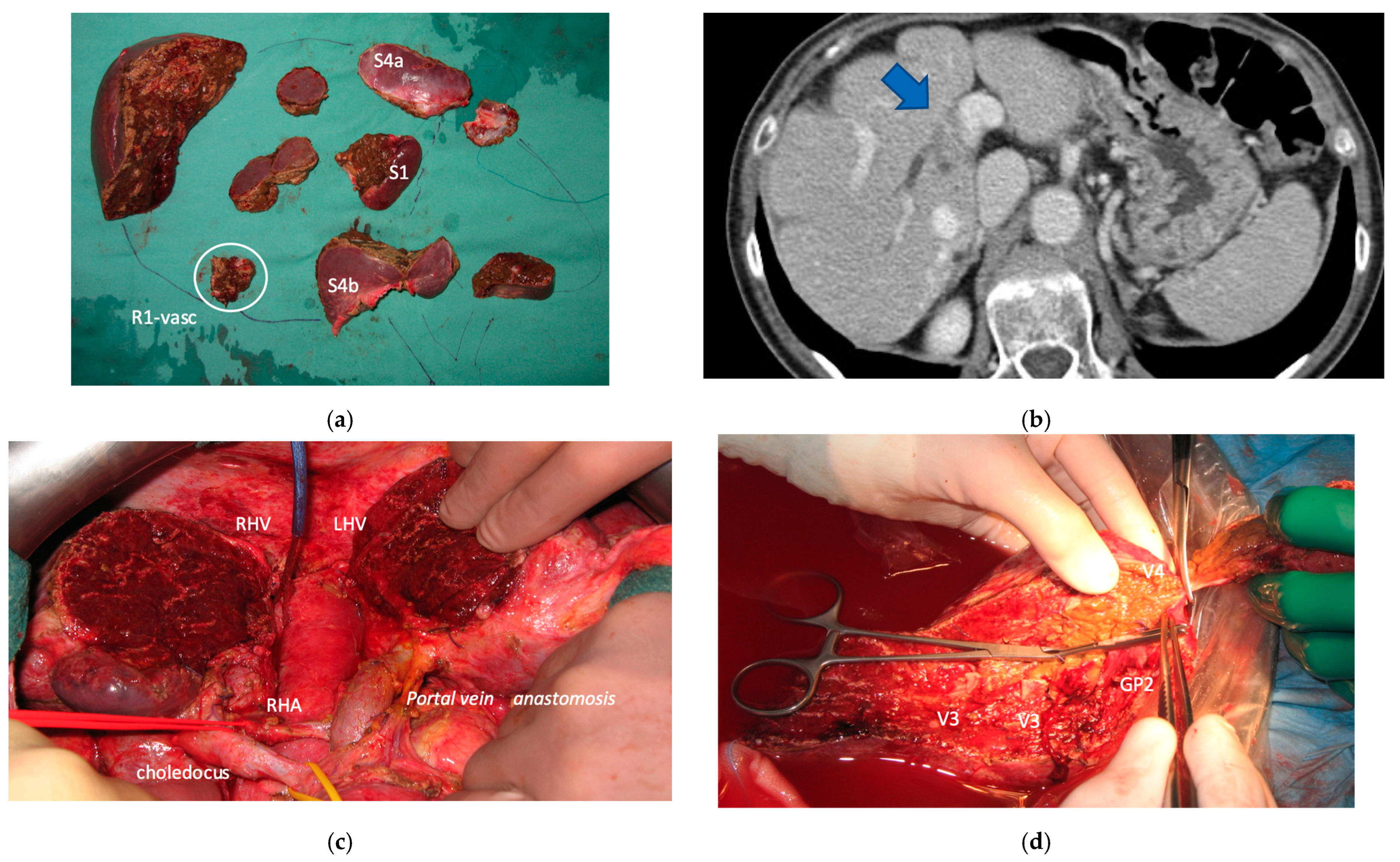 Cancers 15 04683 g015