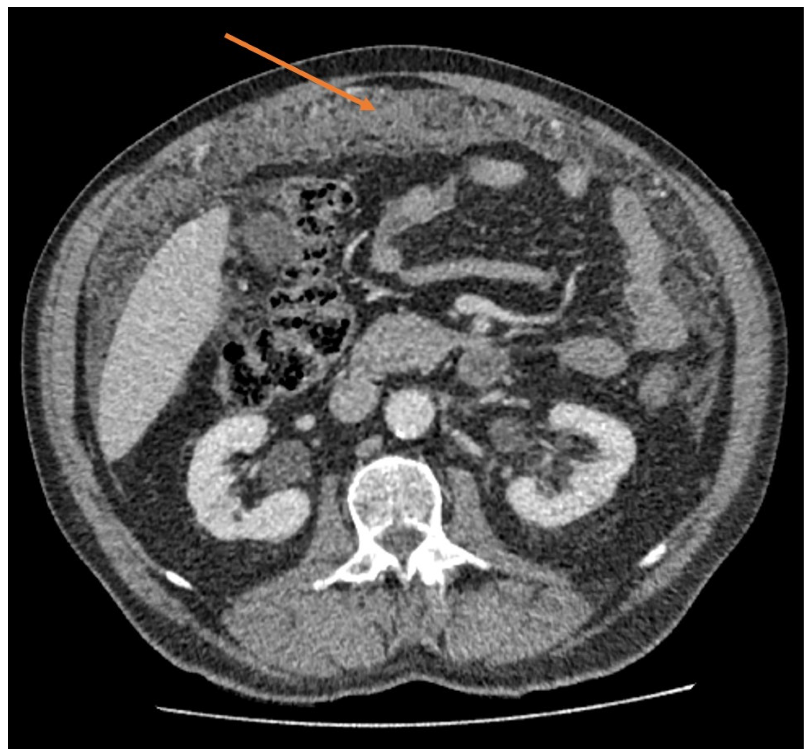 Cancers 15 04704 g001