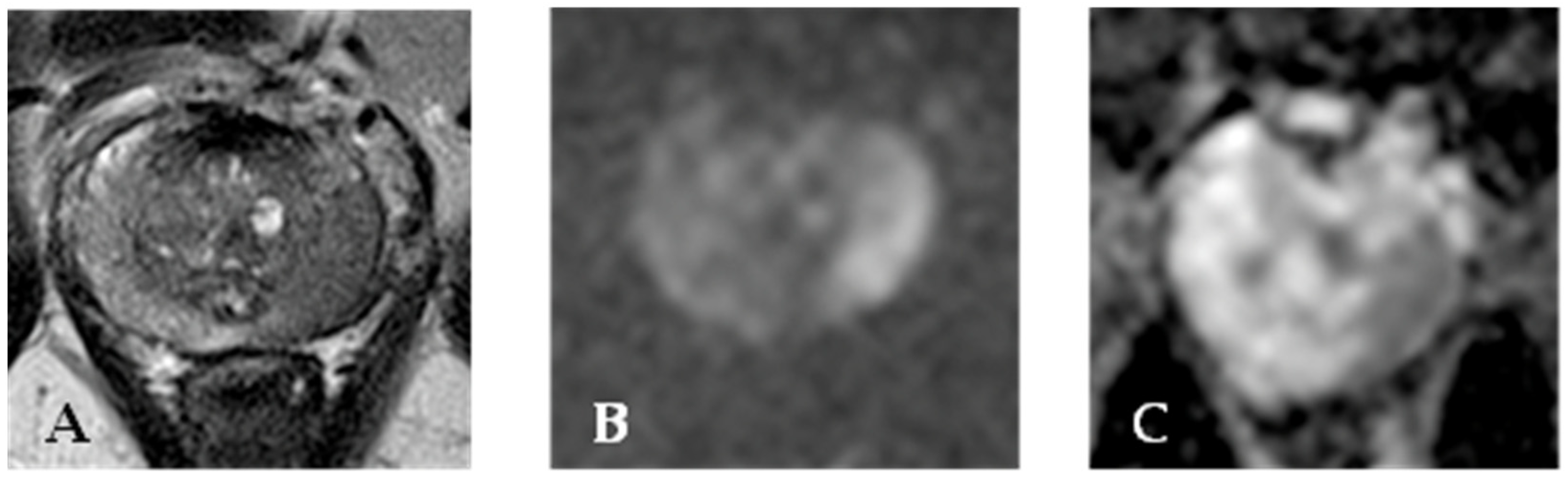 Cancers 15 04746 g002 Cancers 15 04746 g002