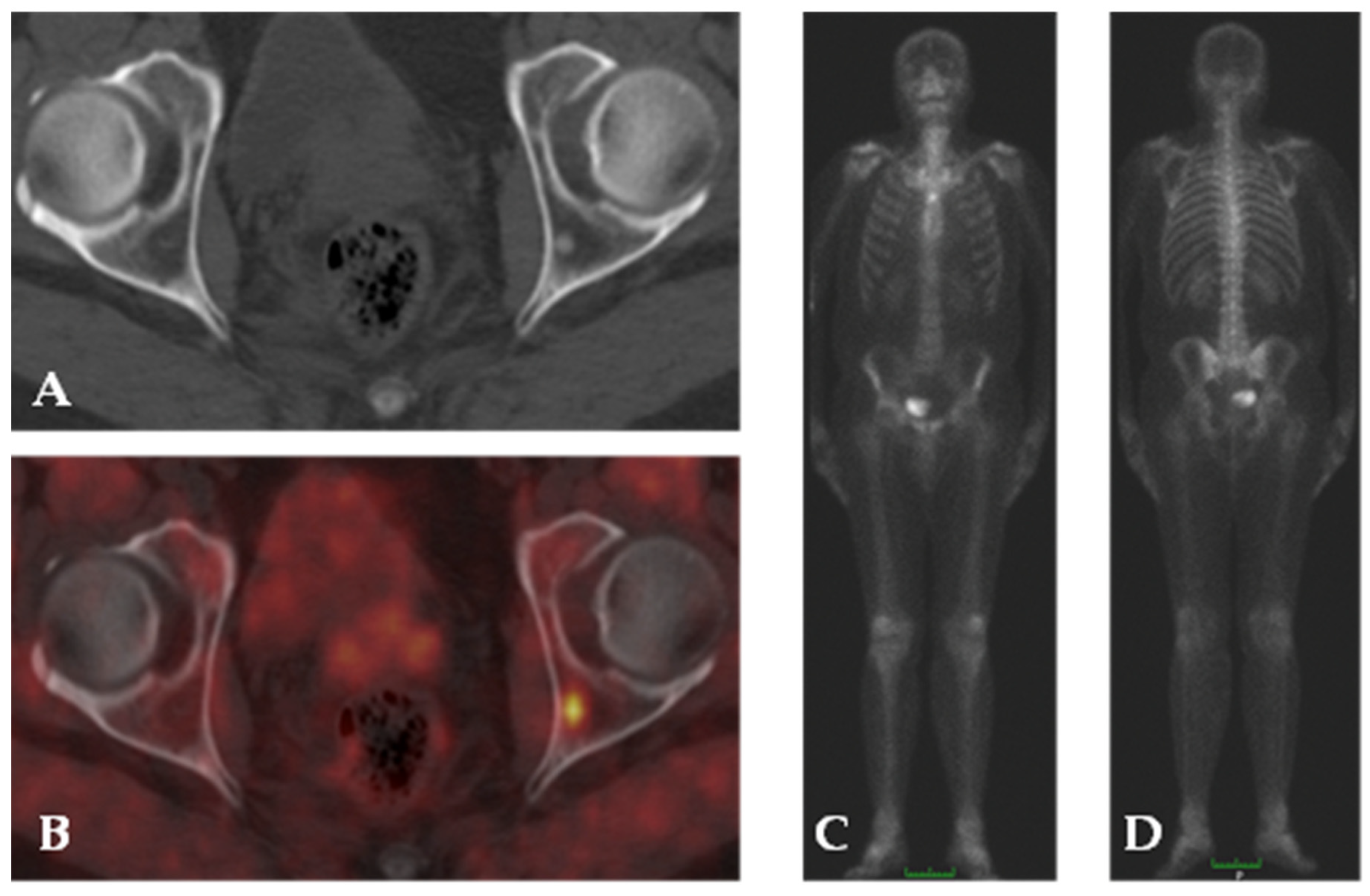 Cancers 15 04746 g005 Cancers 15 04746 g005