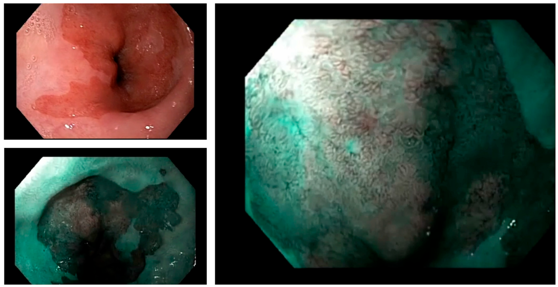 Cancers 15 04776 g001