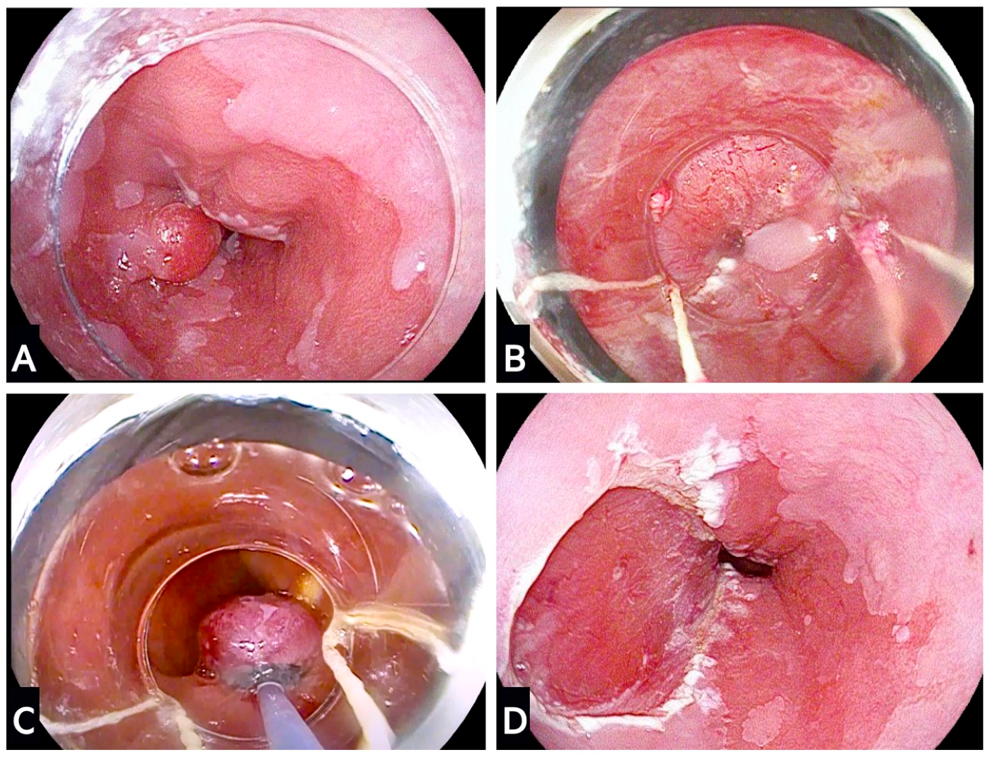 Cancers 15 04776 g002