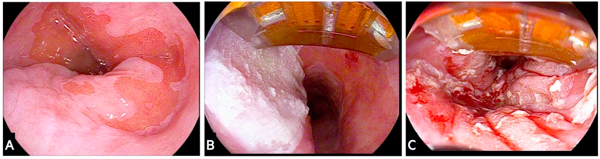 Cancers 15 04776 g004