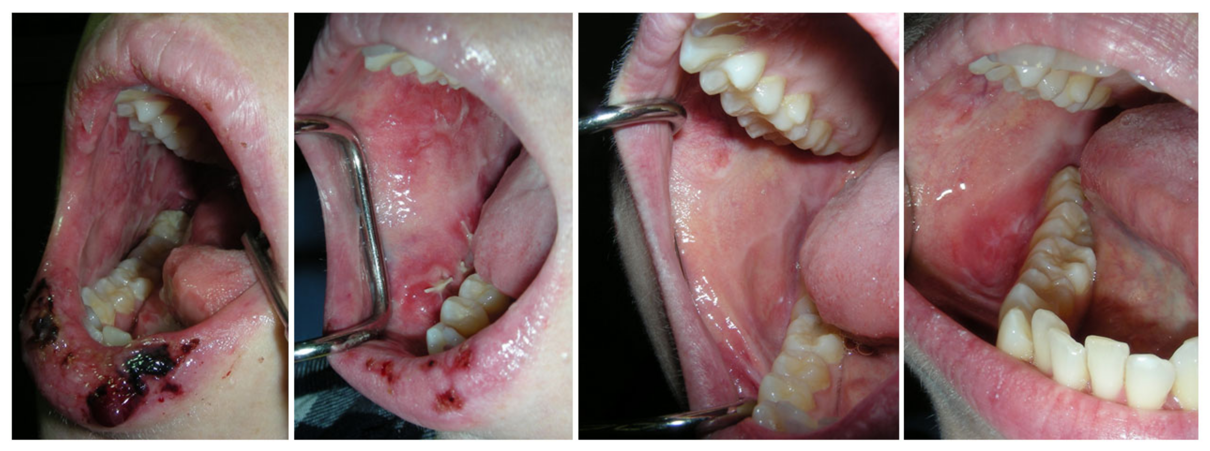 Cancers 15 04781 g002