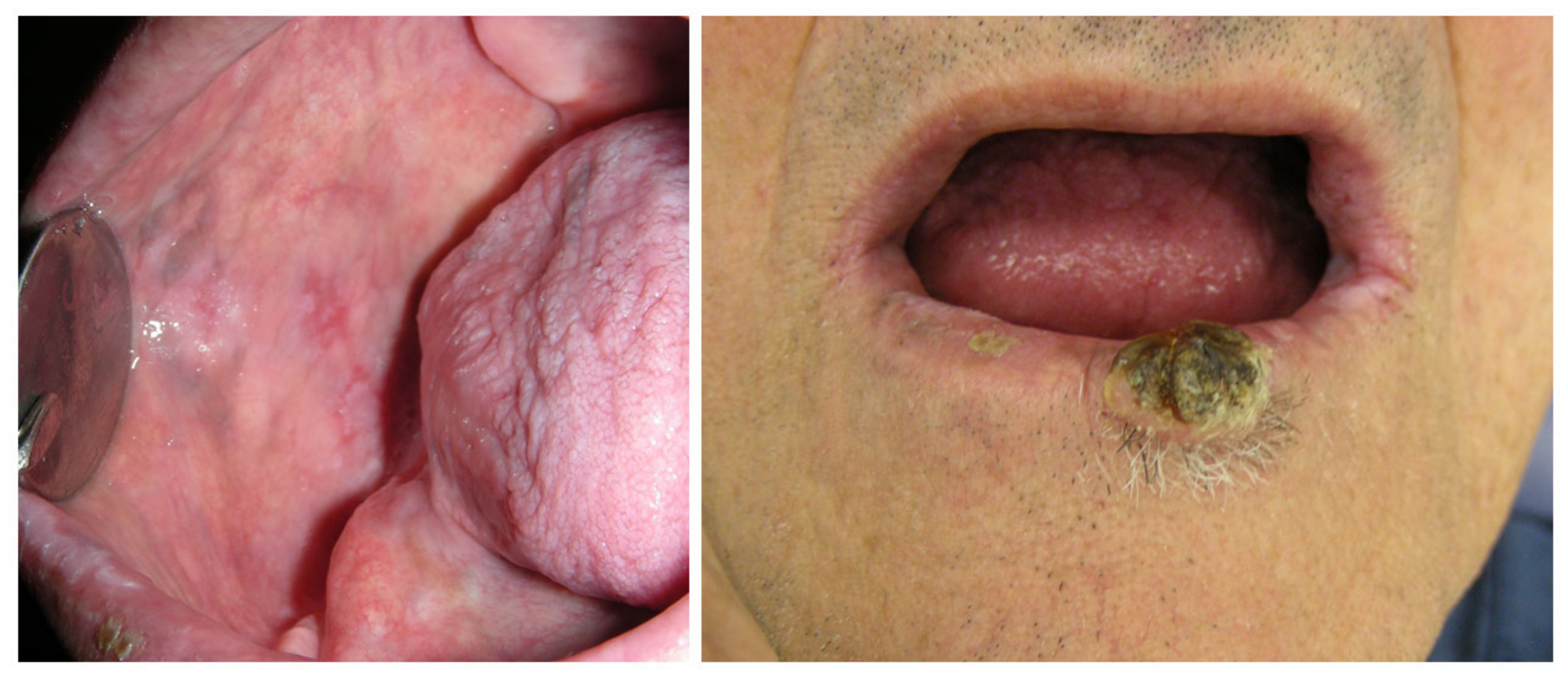 Cancers 15 04781 g003