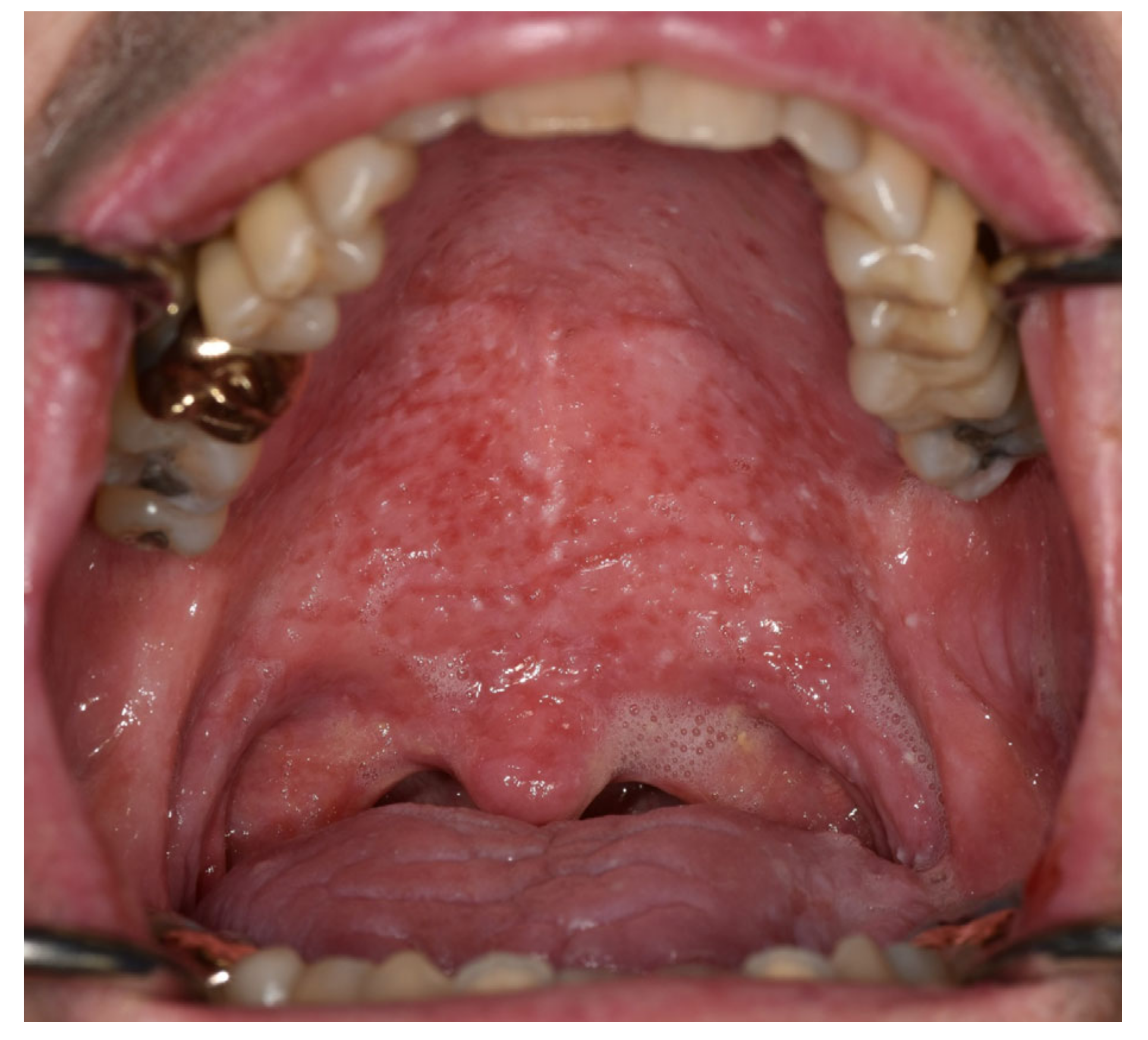 Cancers 15 04781 g004