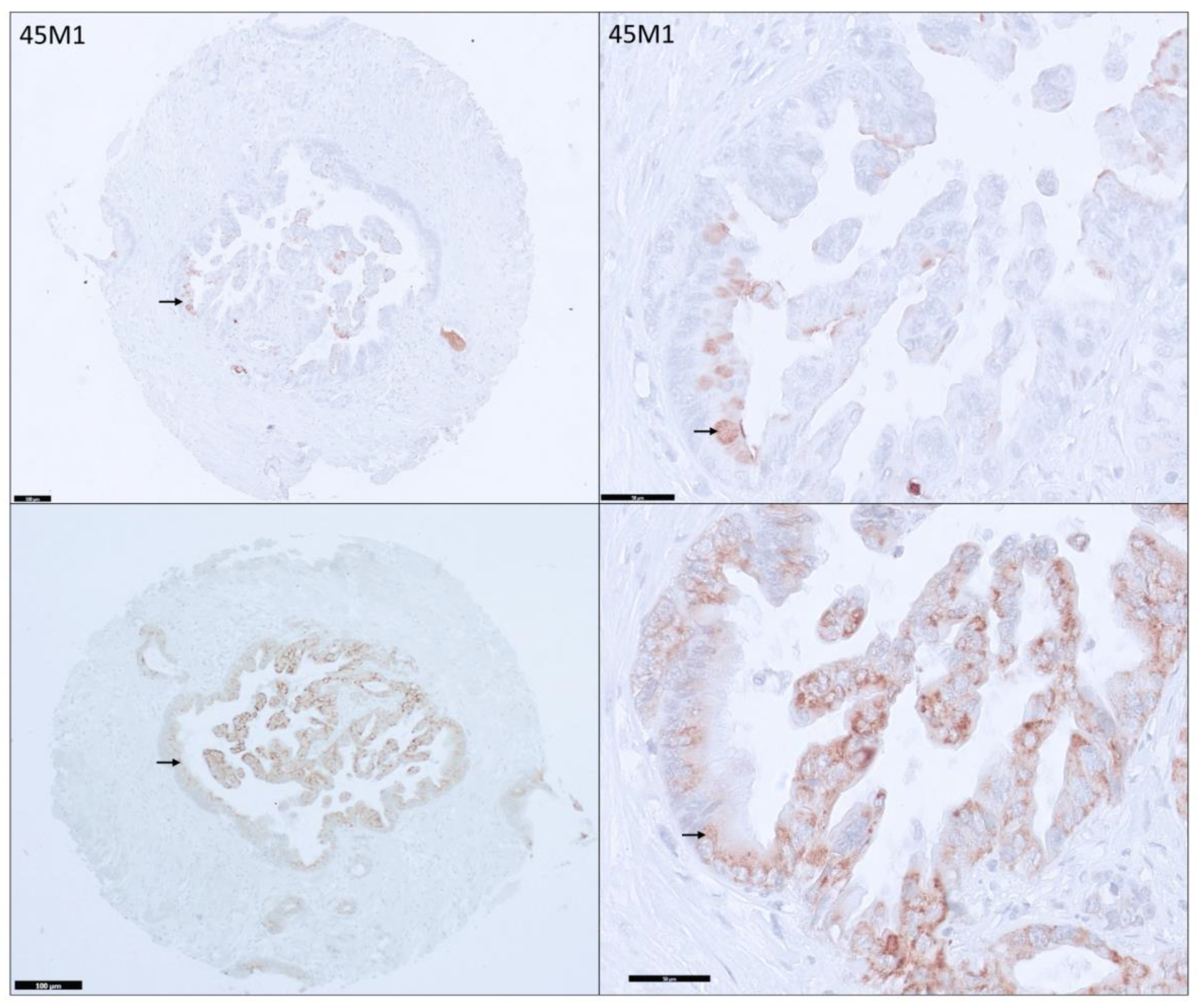 Cancers 15 04832 g004