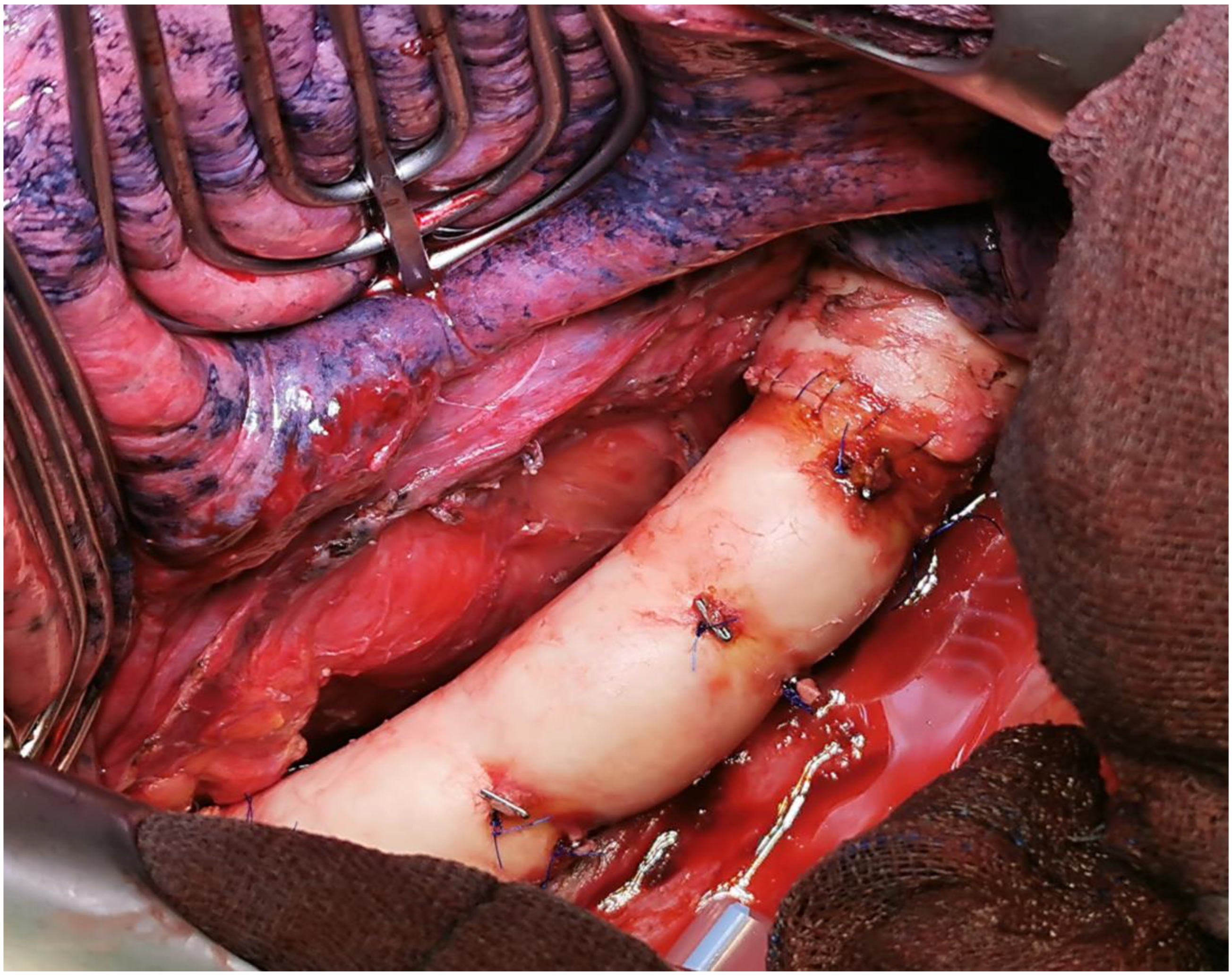 Cancers 15 04847 g002 Cancers 15 04847 g002