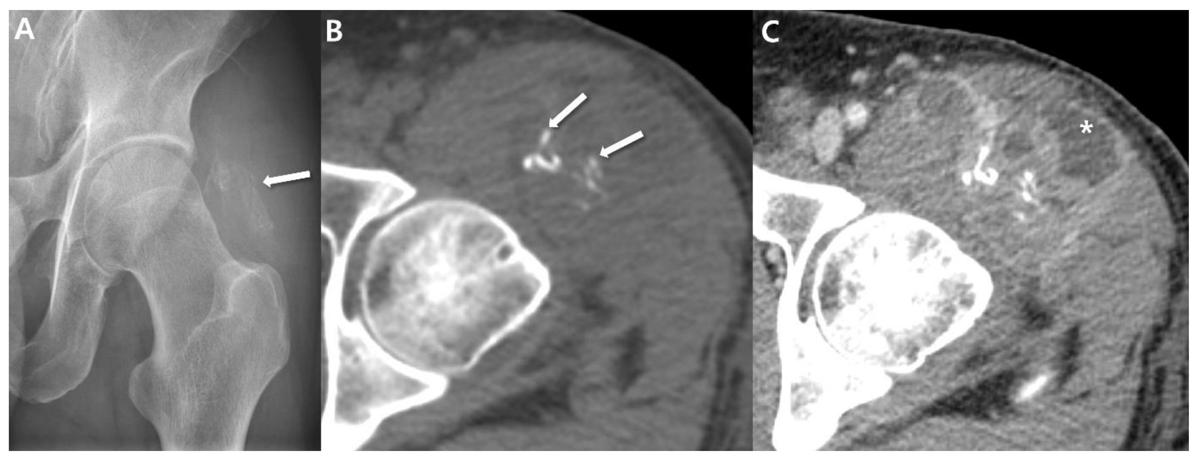 Cancers 15 04860 g002