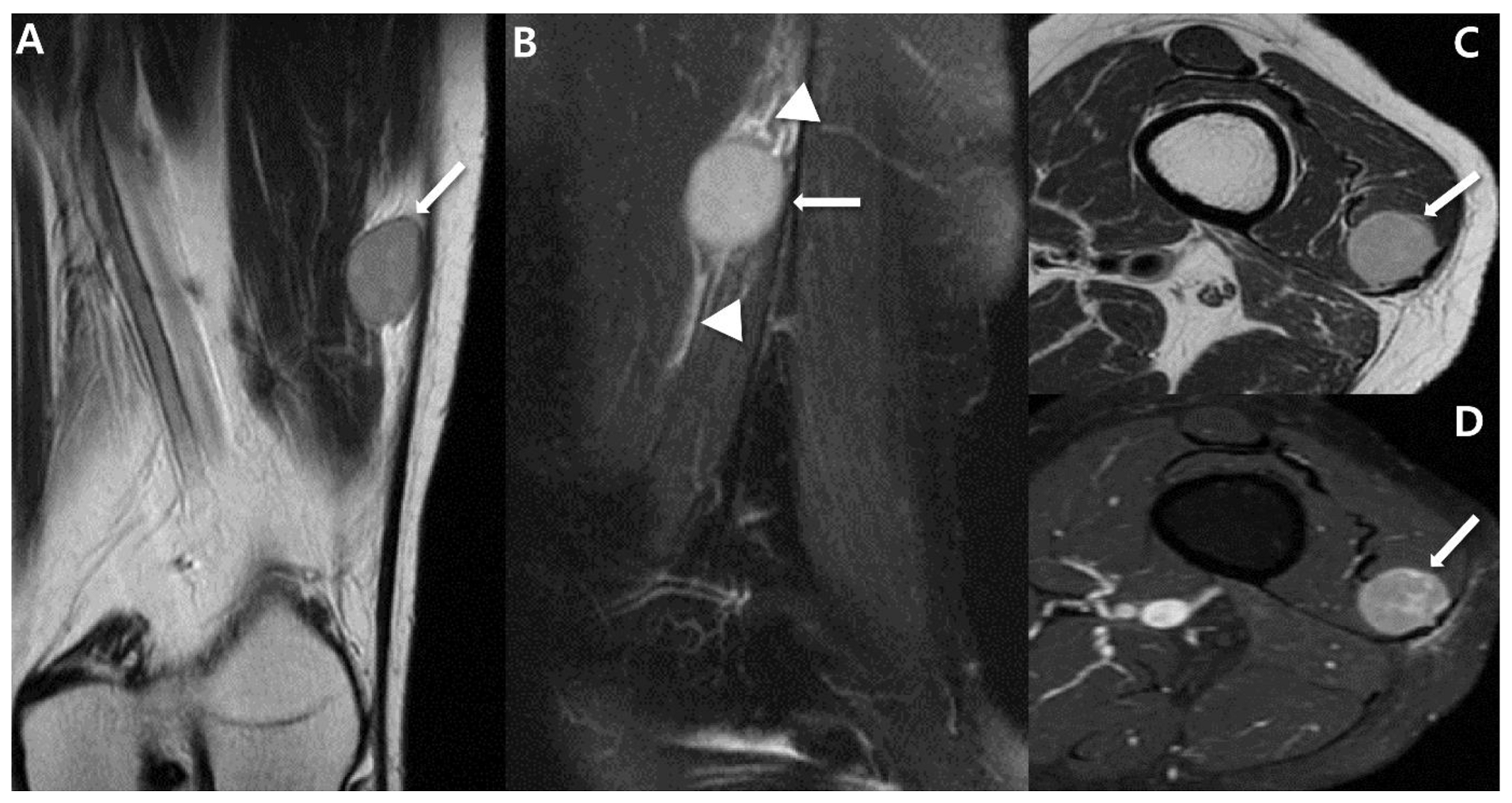 Cancers 15 04860 g004