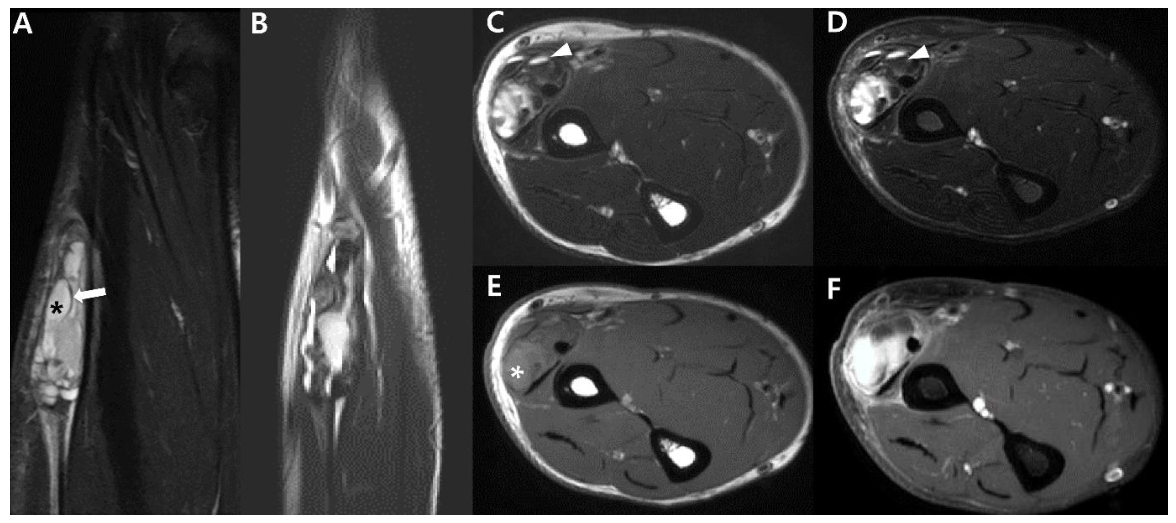 Cancers 15 04860 g006