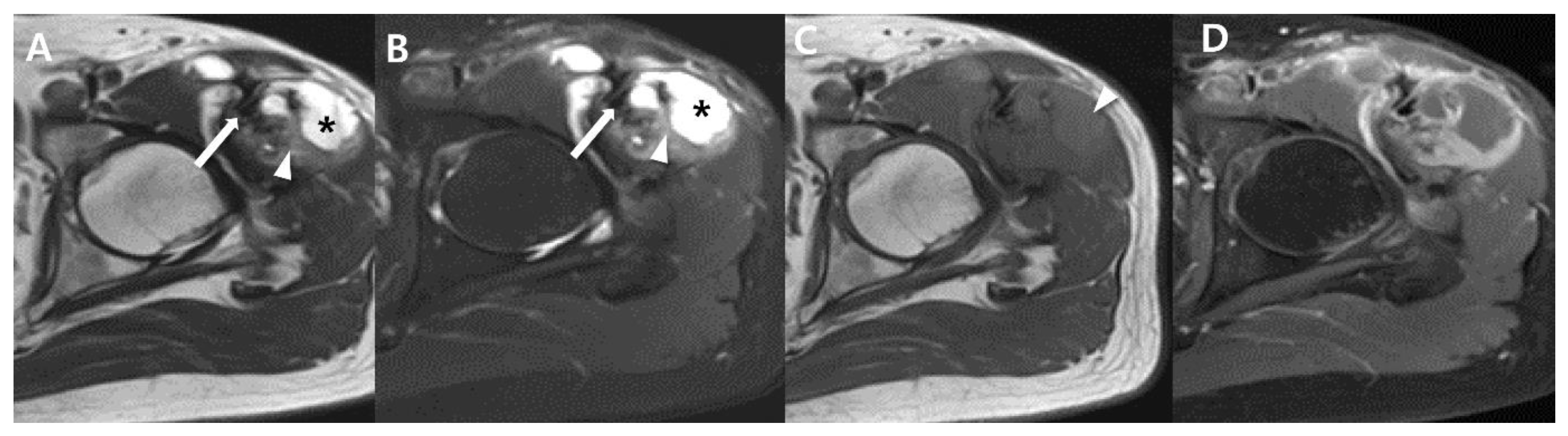 Cancers 15 04860 g007