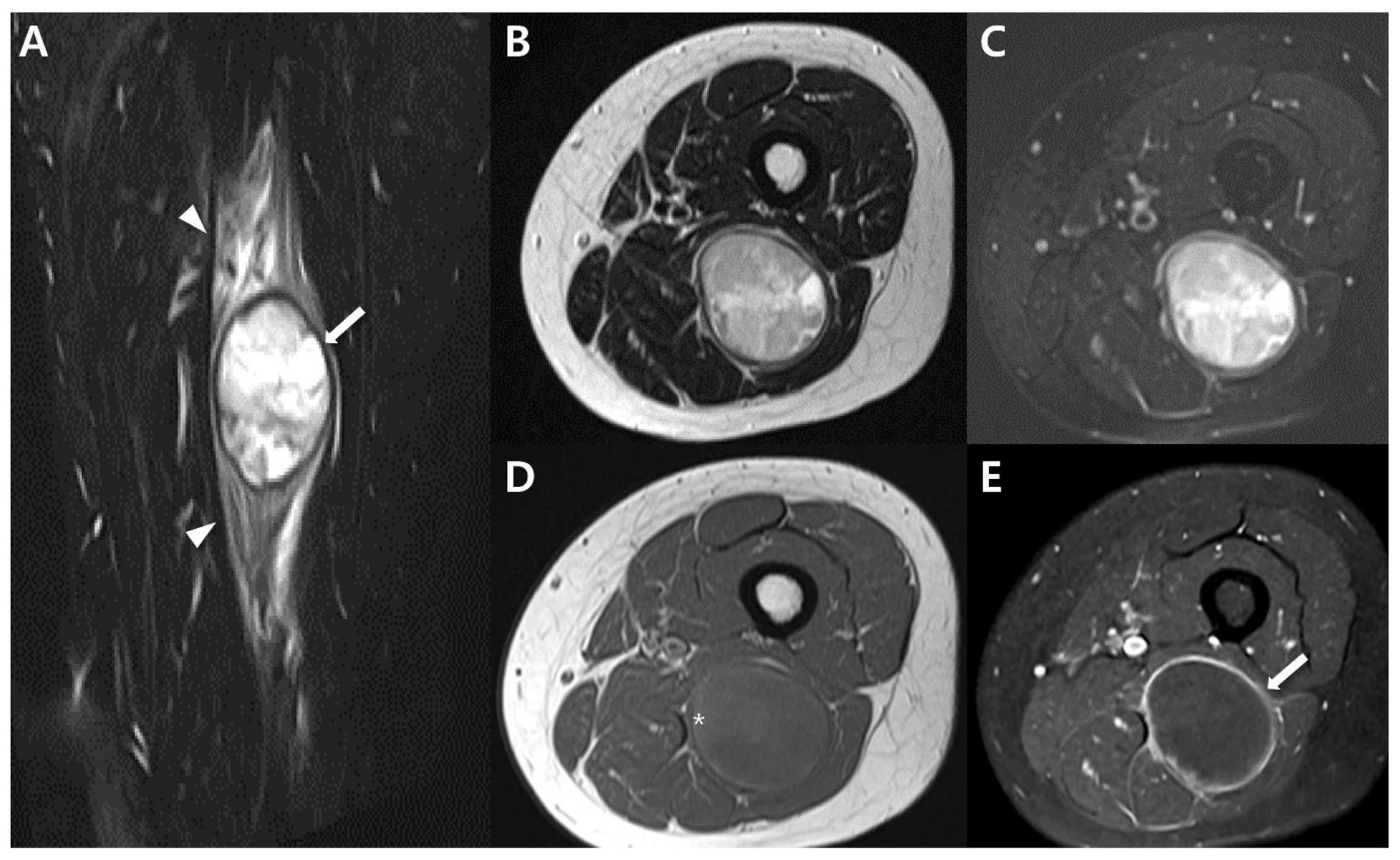 Cancers 15 04860 g010