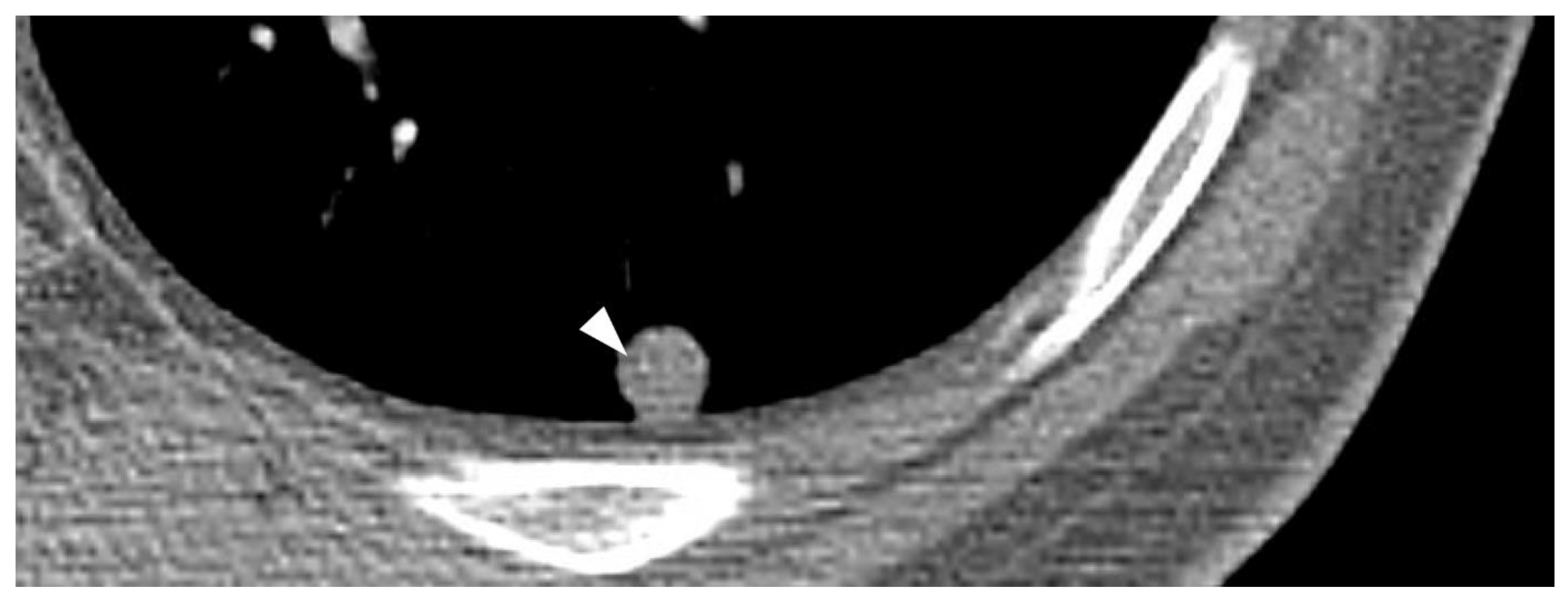 Cancers 15 04860 g011