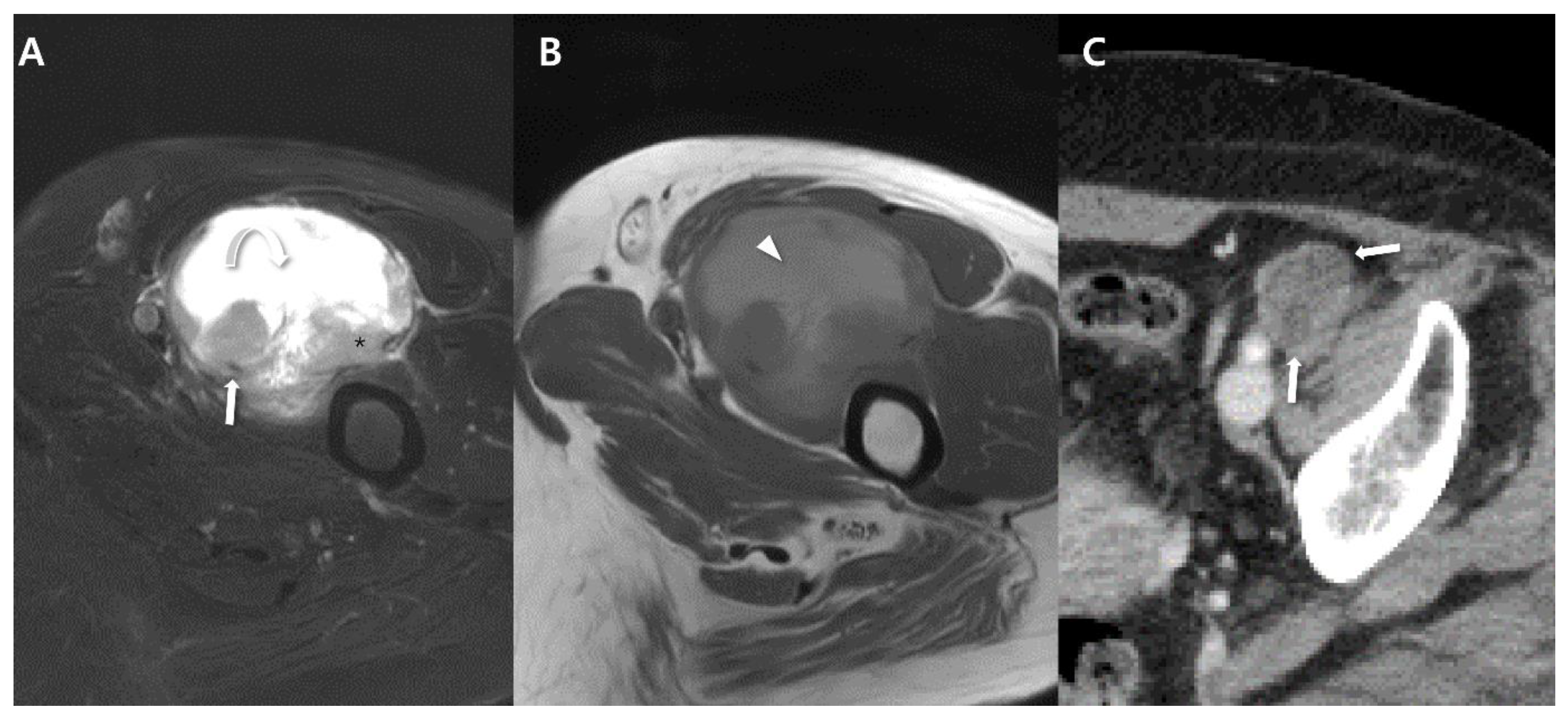 Cancers 15 04860 g012