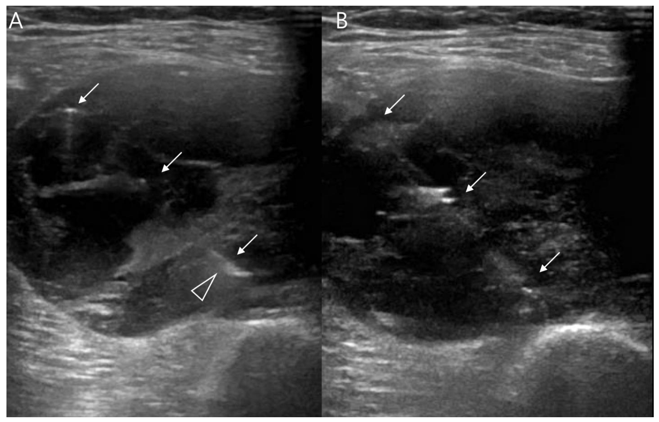 Cancers 15 04860 g014