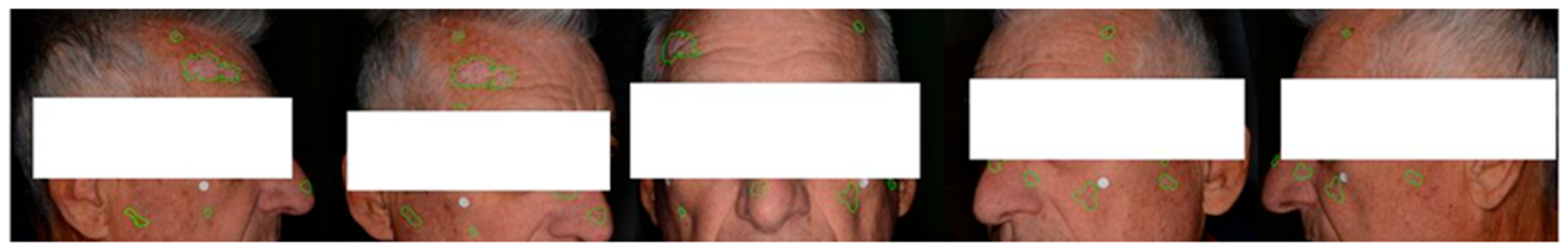 Cancers 15 04861 g005