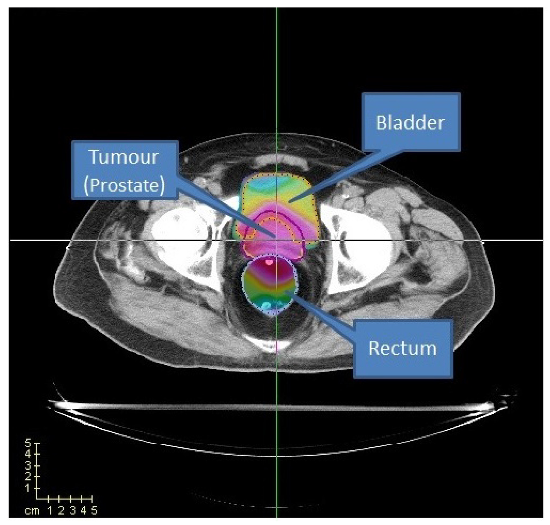 Cancers 15 04868 g013