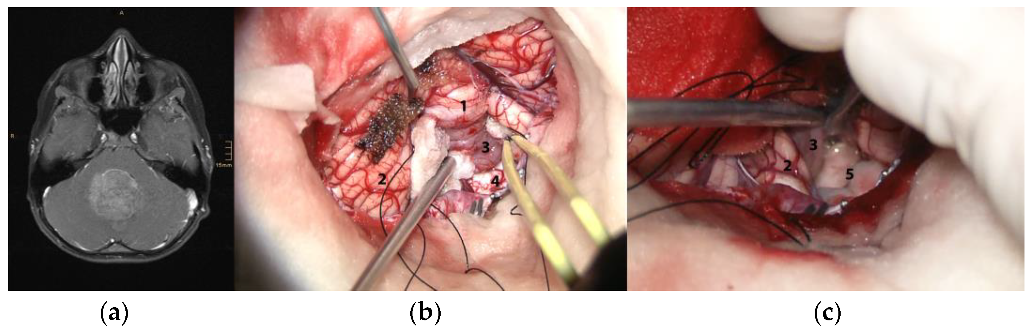 Cancers 15 04877 g002