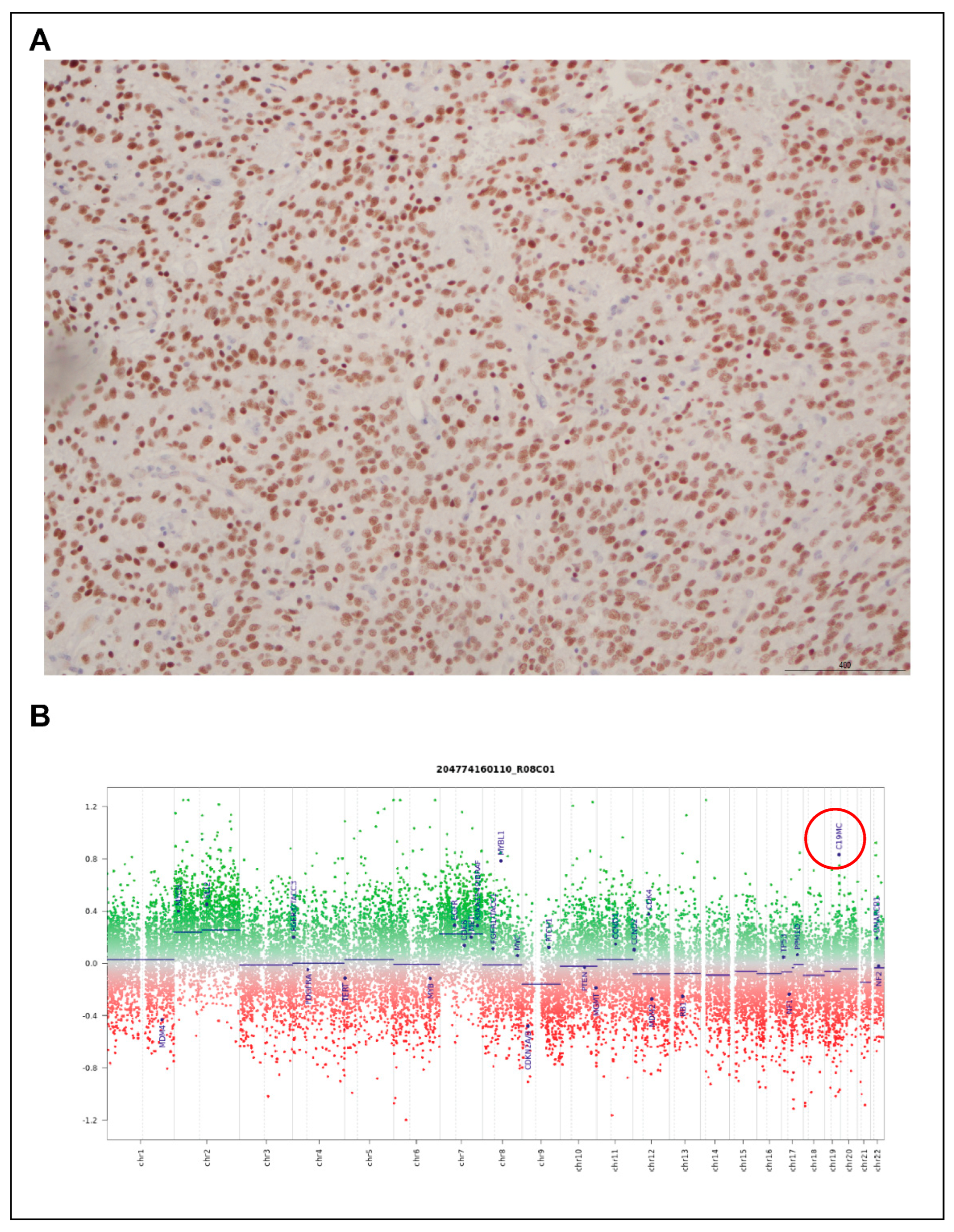 Cancers 15 04880 g005