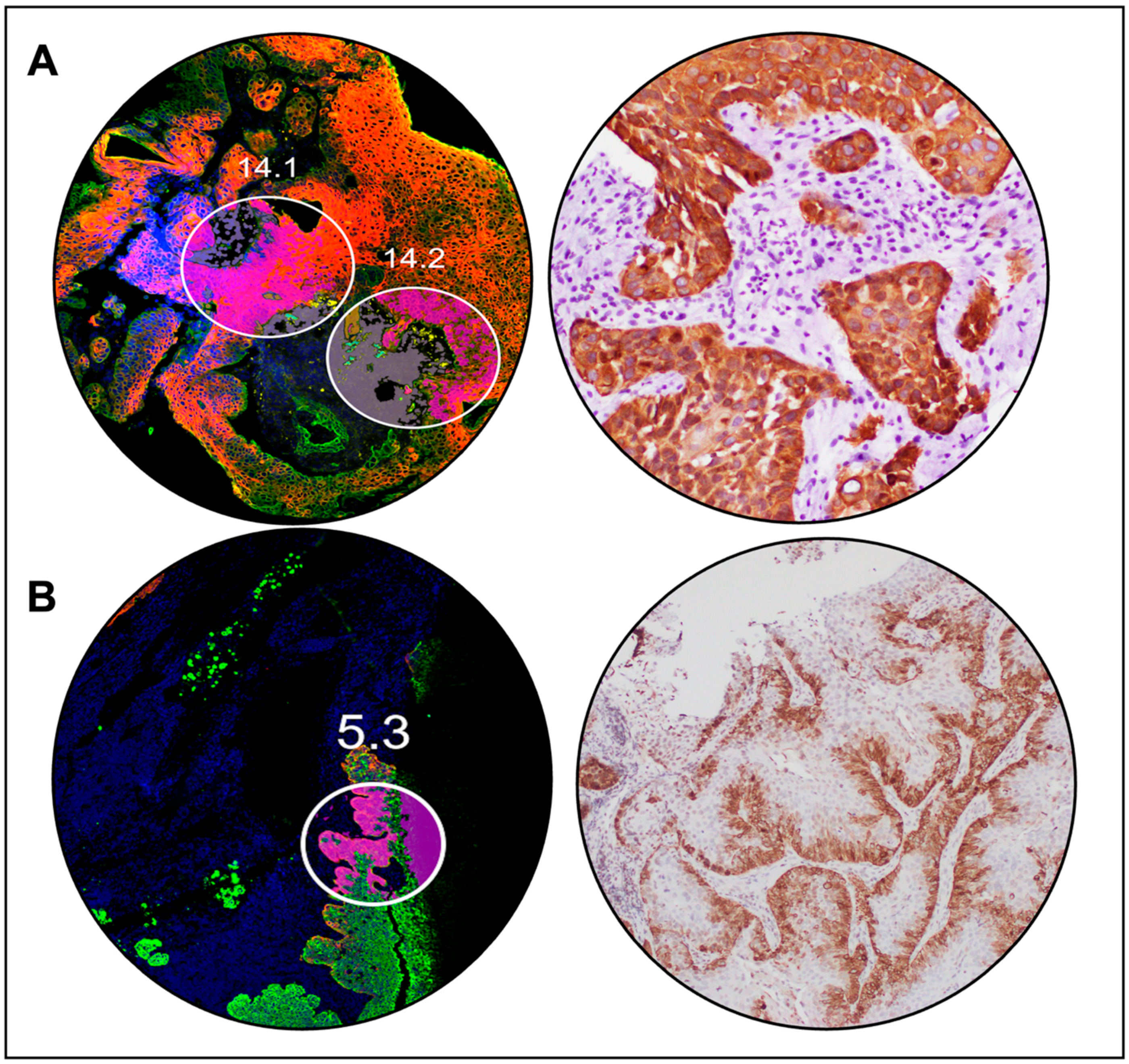 Cancers 15 04905 g004