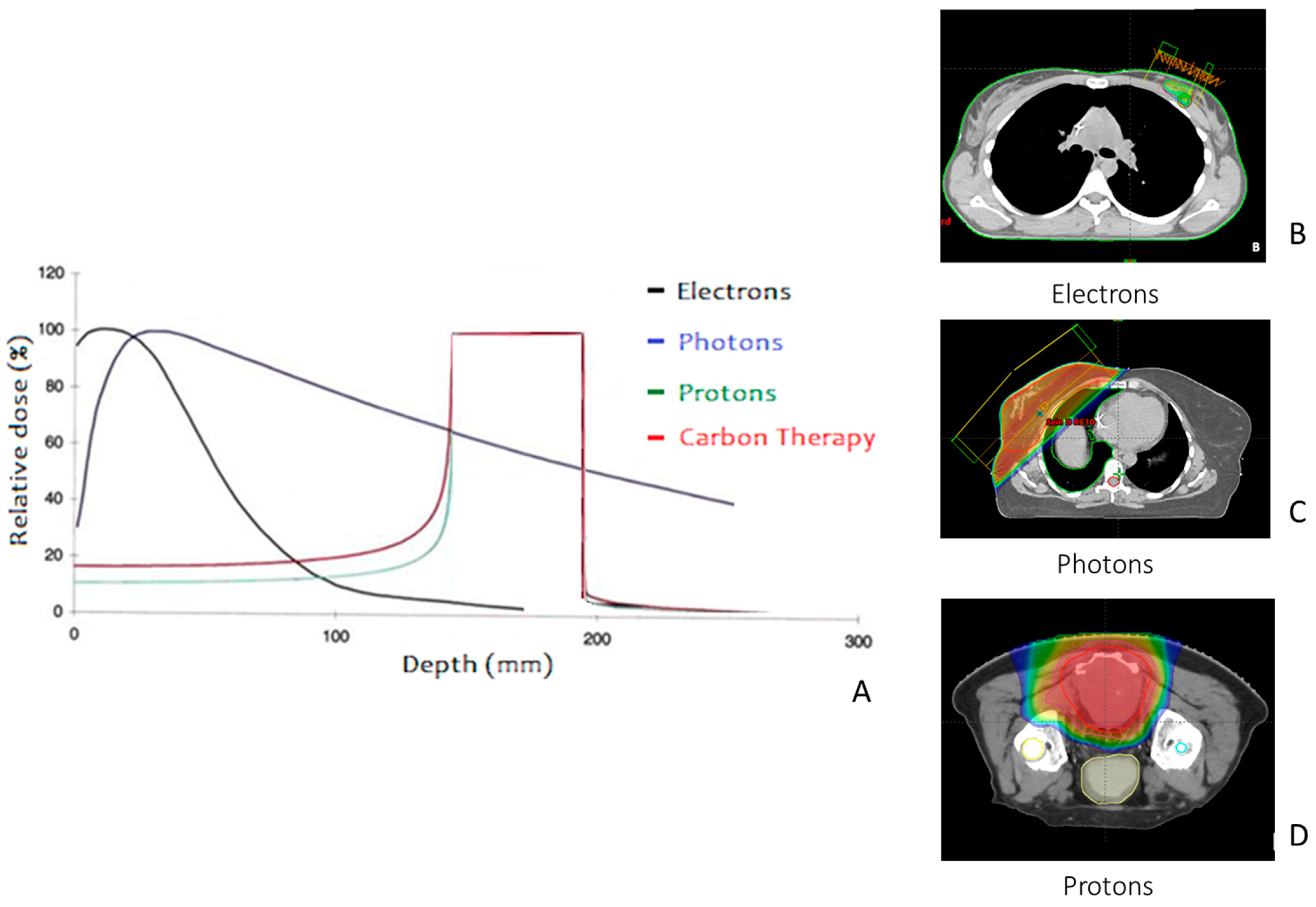 Cancers 15 04906 g001 Cancers 15 04906 g001