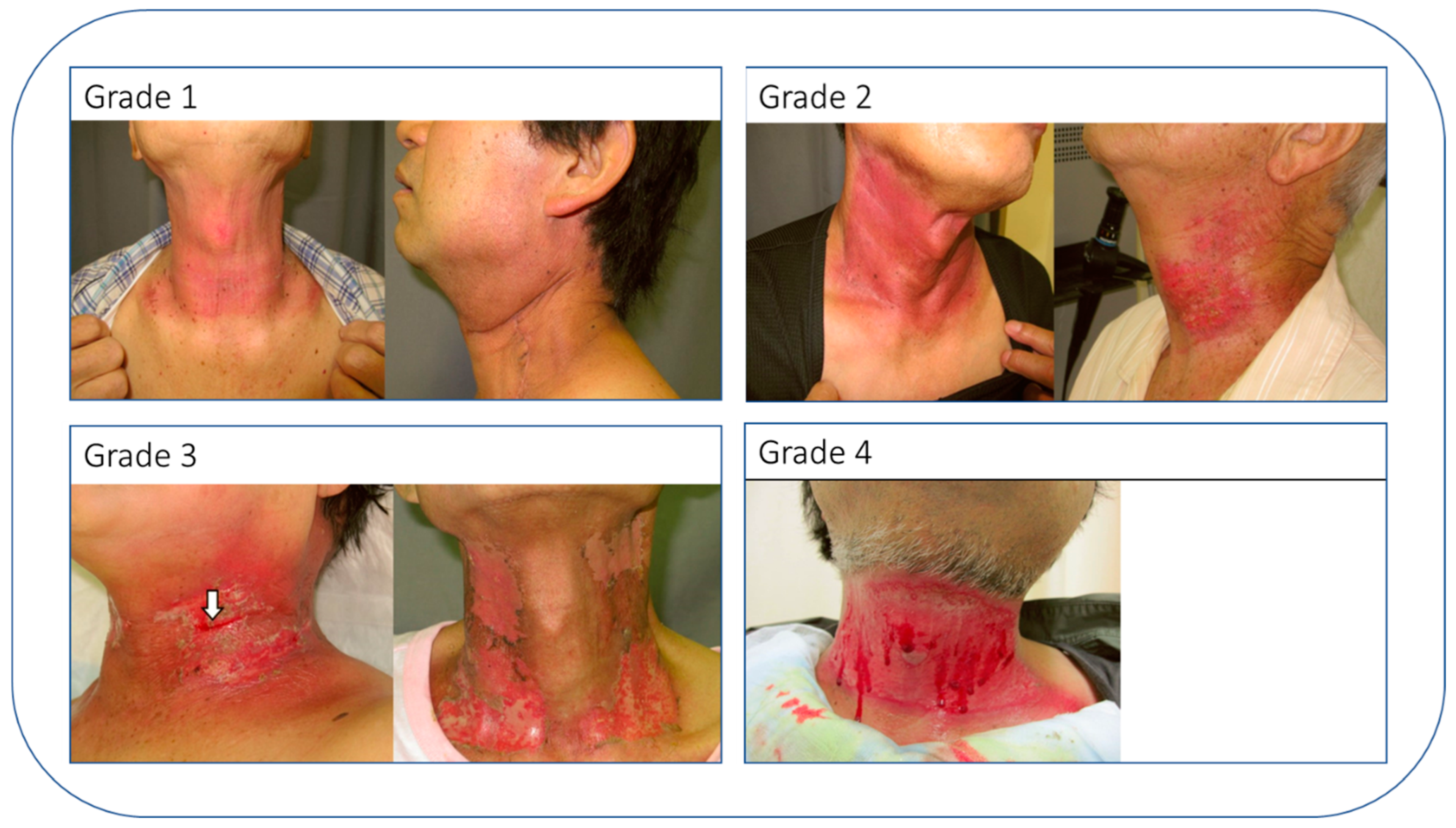 Cancers 15 04906 g005 Cancers 15 04906 g005