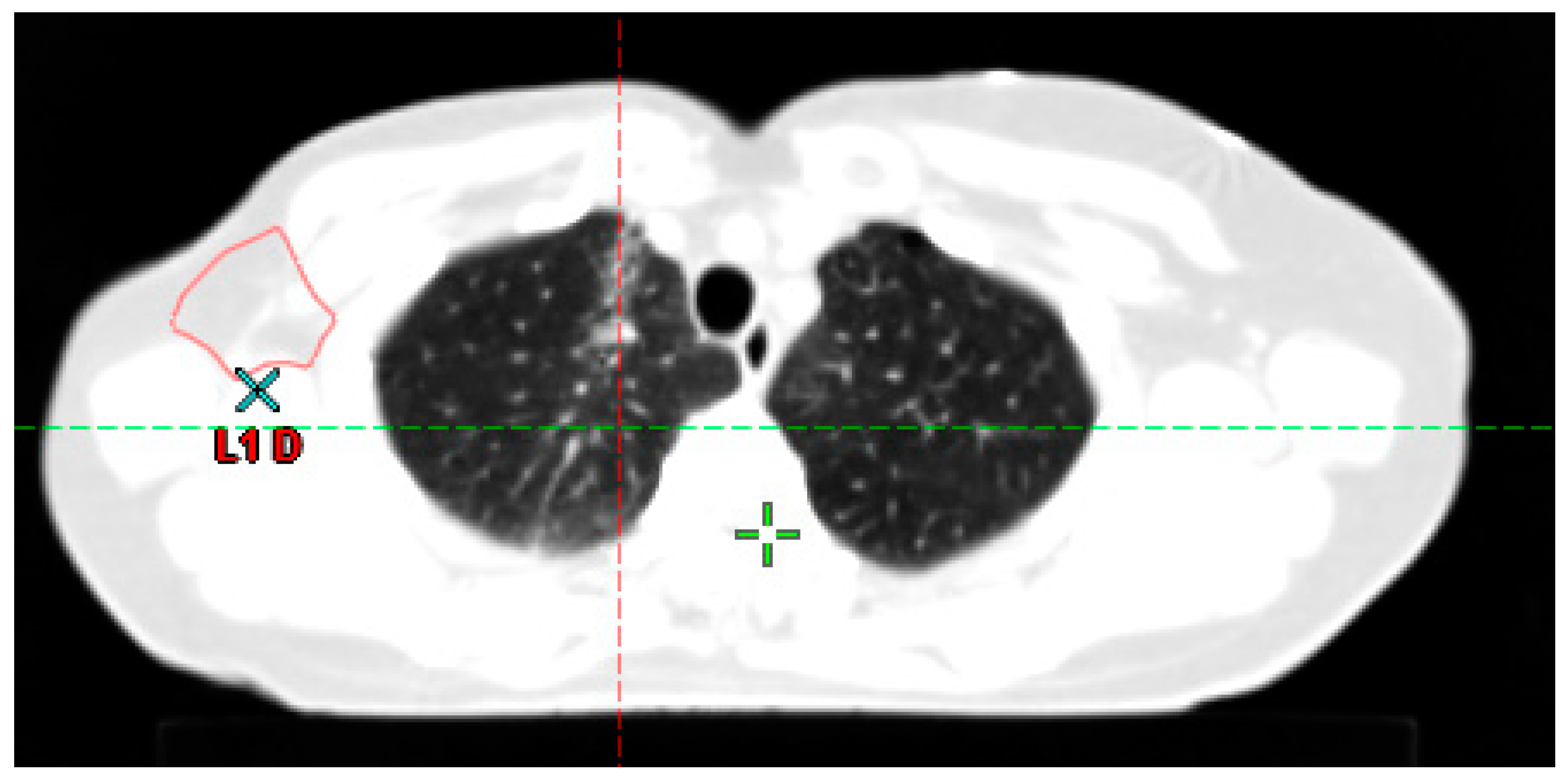 Cancers 15 04906 g006 Cancers 15 04906 g006