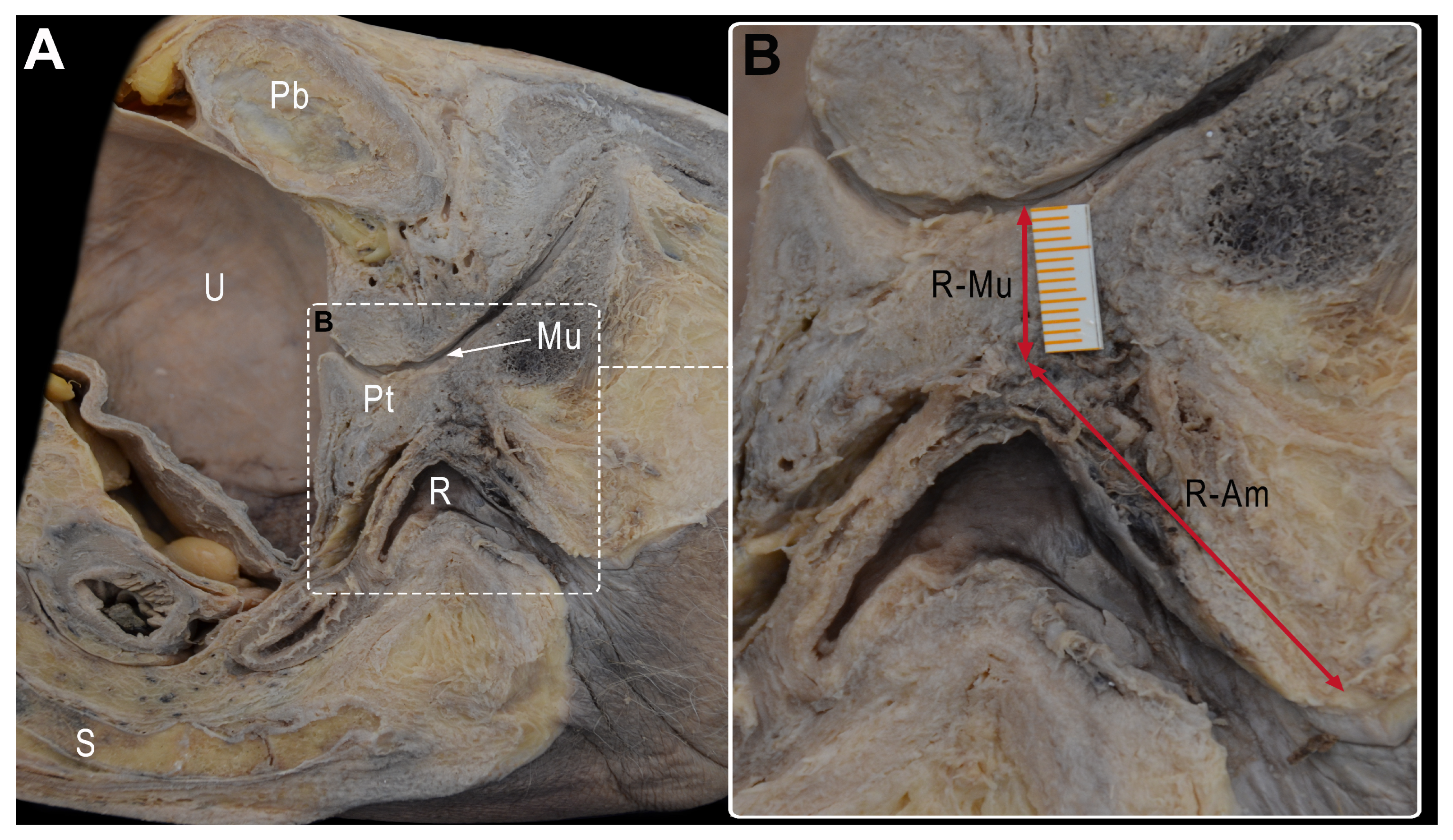 Cancers 15 04955 g002