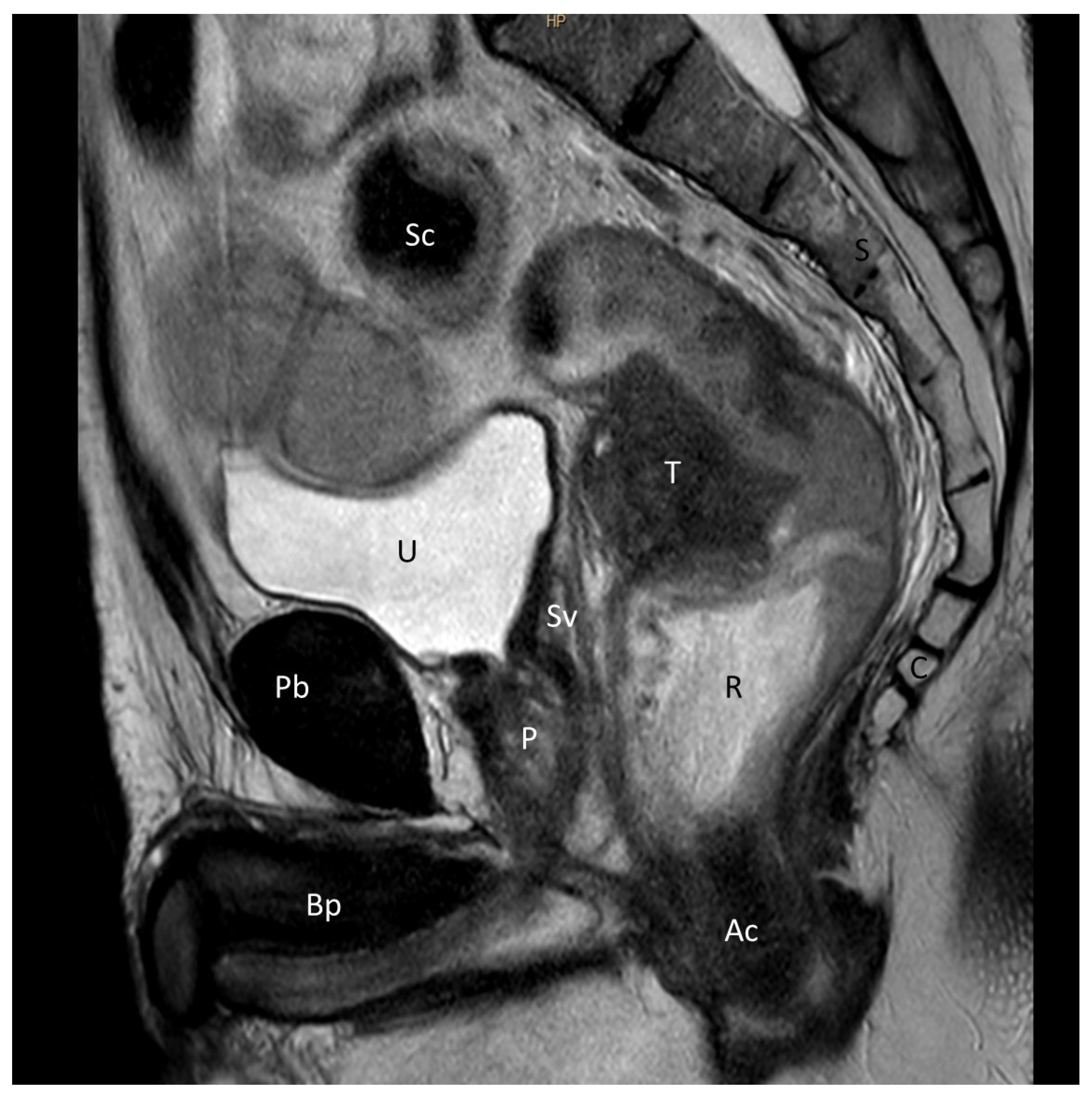 Cancers 15 04955 g004