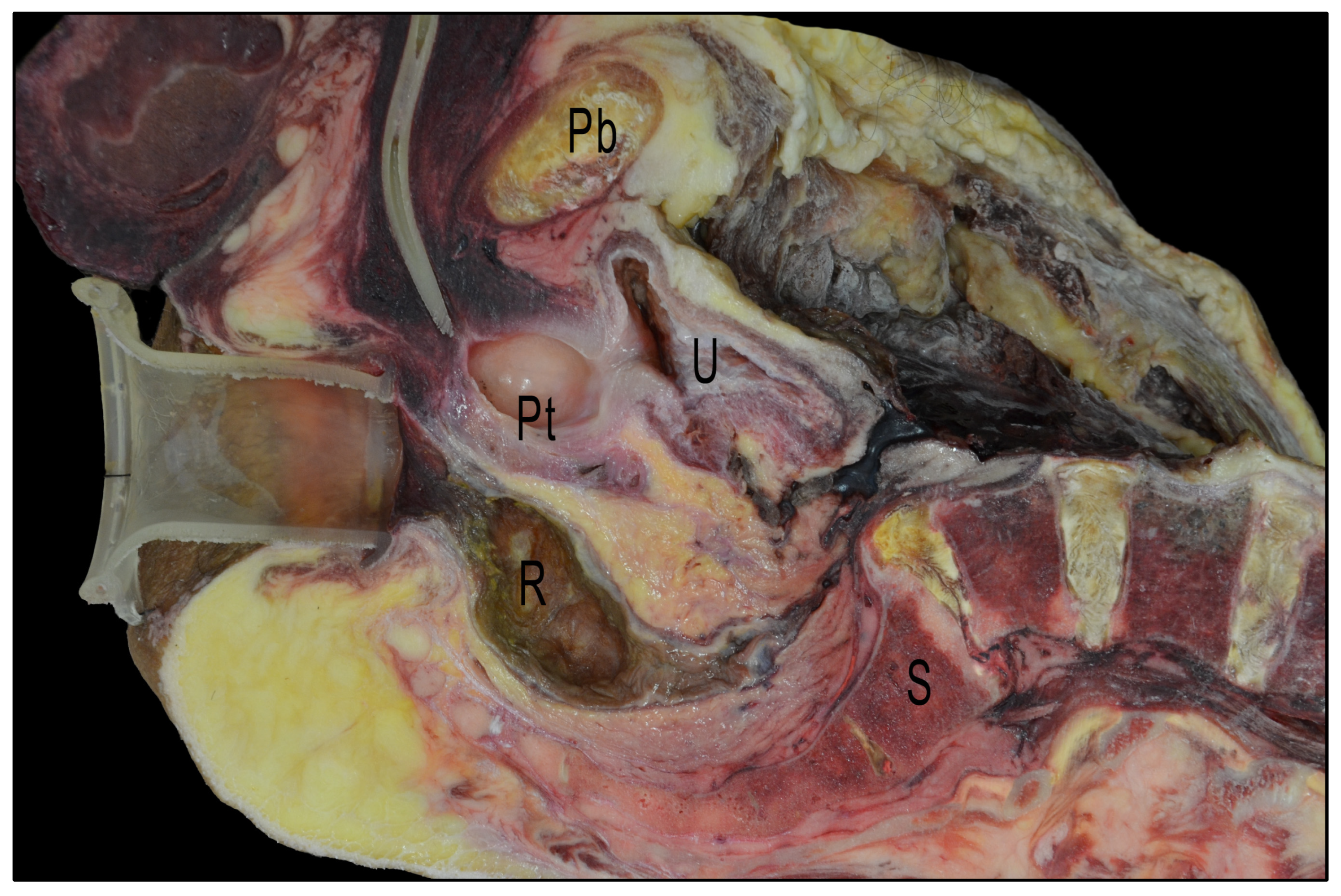 Cancers 15 04955 g007