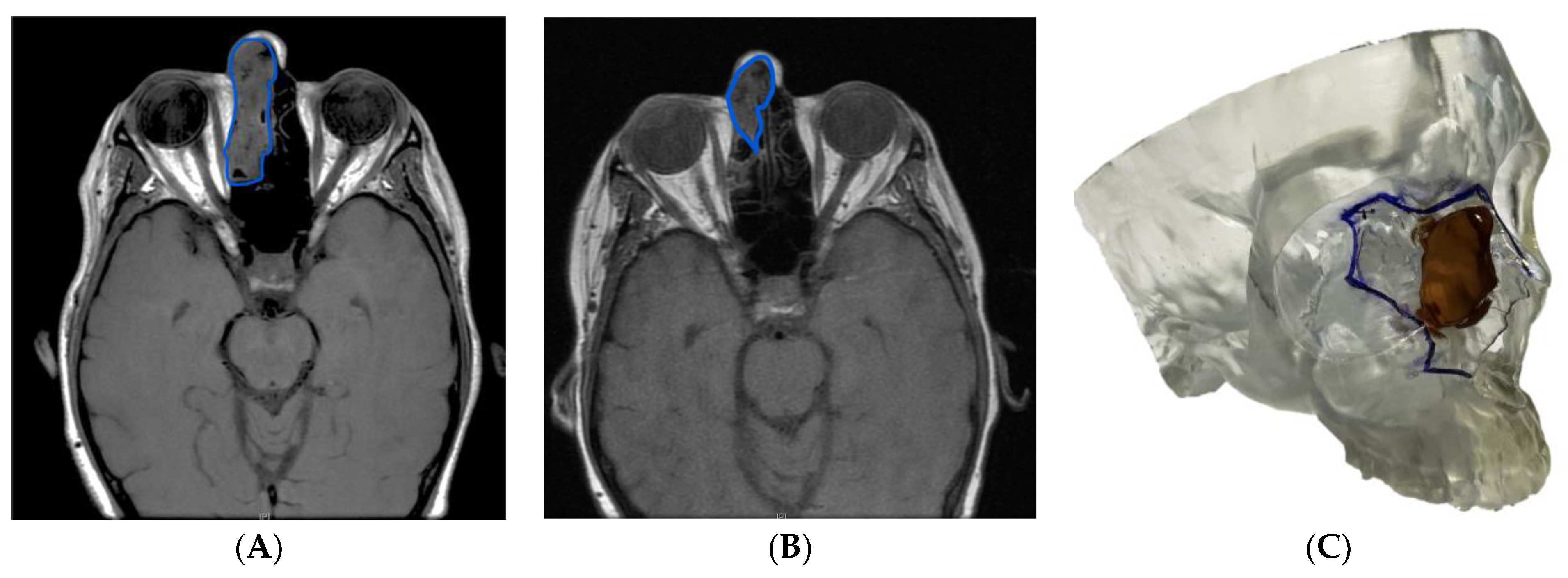 Cancers 15 04989 g001