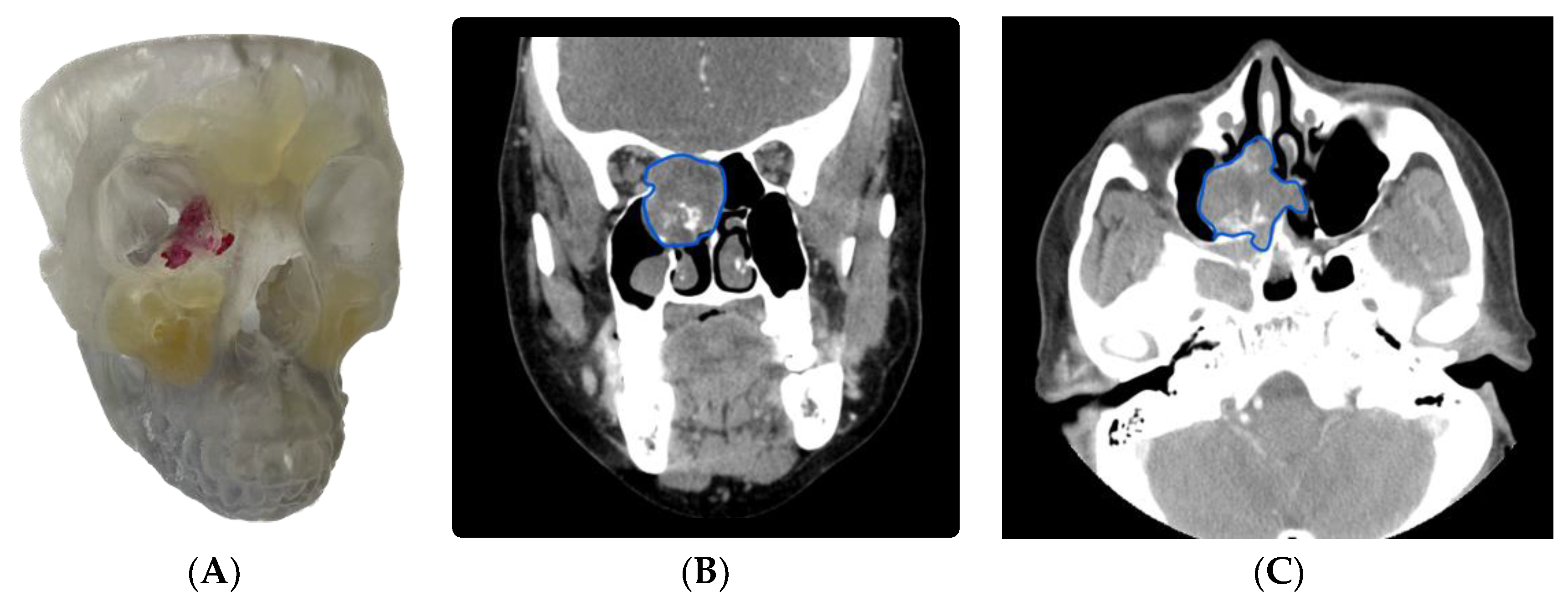 Cancers 15 04989 g003