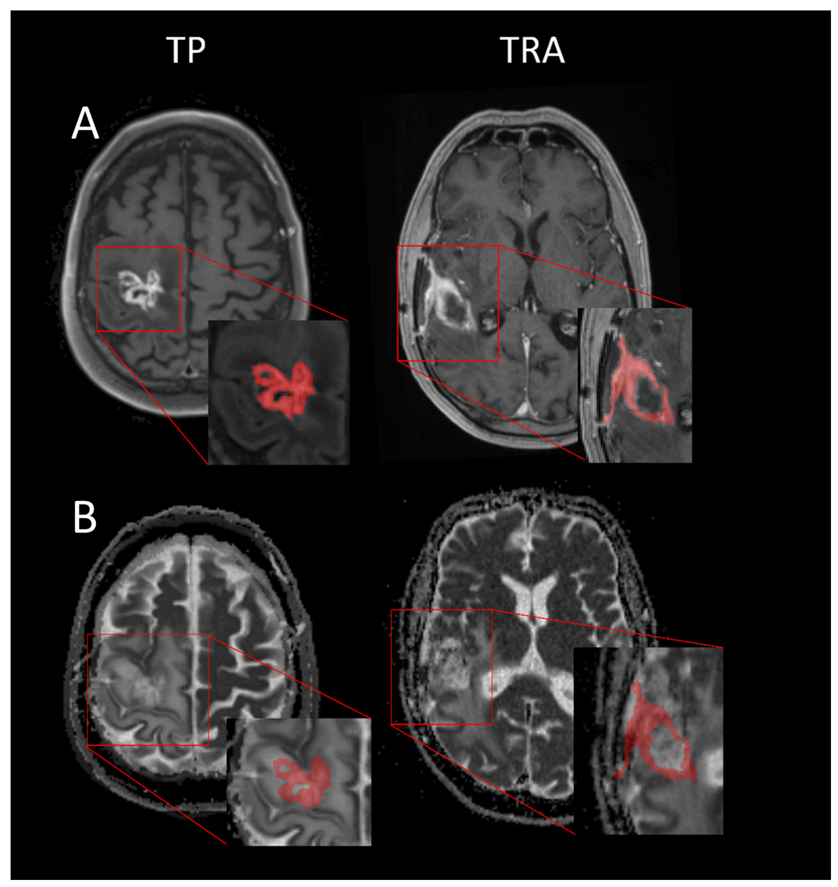 Cancers 15 04990 g001