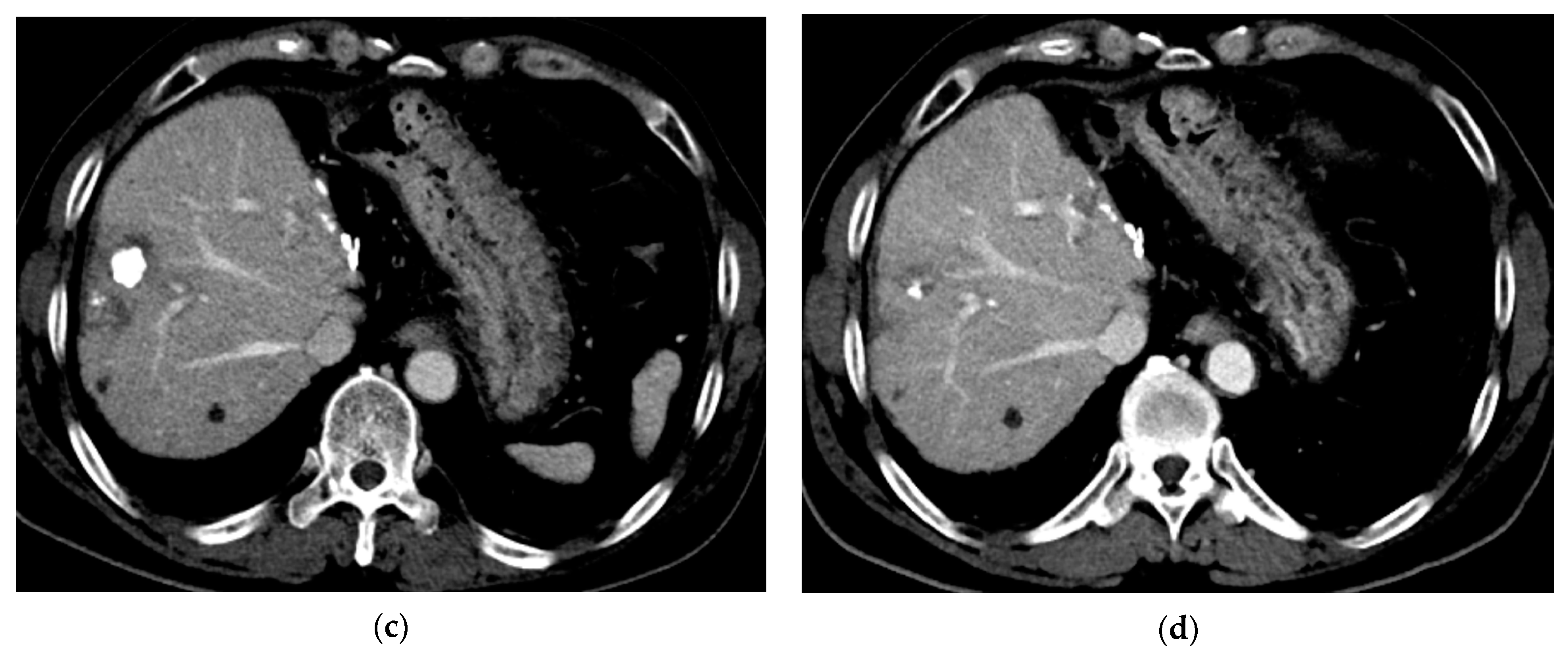 Cancers 15 04991 g004b