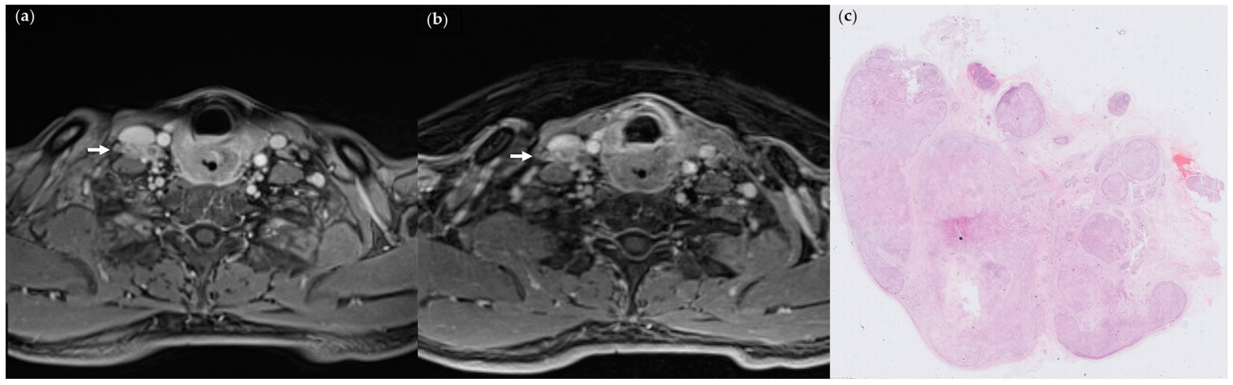 Cancers 15 04992 g002